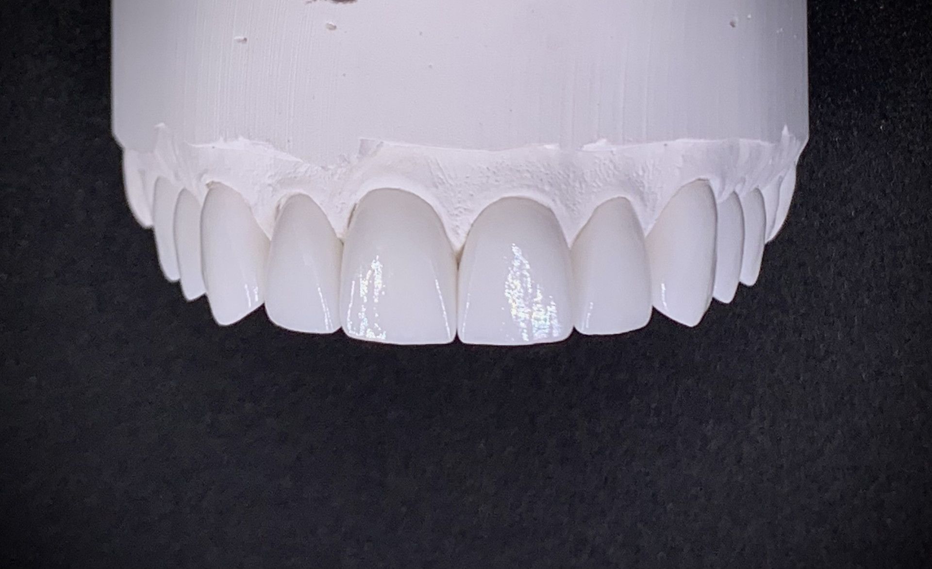 Dental model with bright white veneers, against a black background— AB Esthetic Dental Laboratory in Robina, QLD