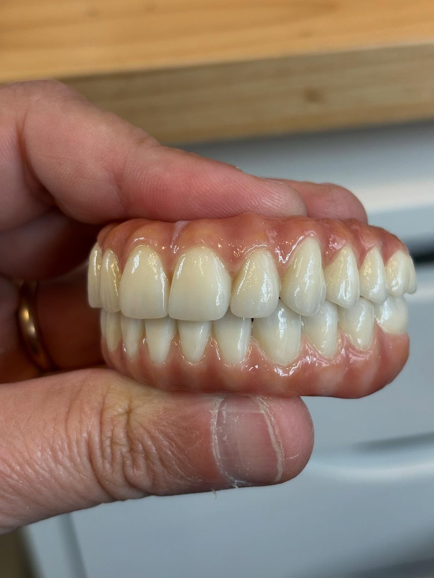 A set of upper and lower dentures held in a person’s hand; the gums are pink, teeth are white— AB Esthetic Dental Laboratory in Robina, QLD