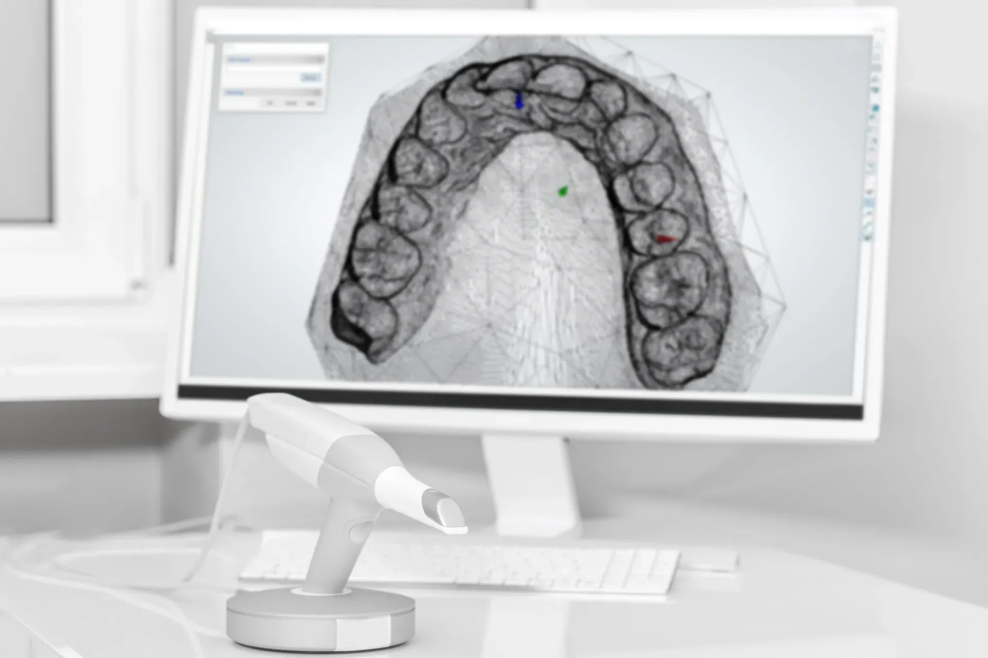 Dental scan of teeth on a computer screen, with a digital scanner in the foreground. — AB Esthetic Dental Laboratory in Robina, QLD