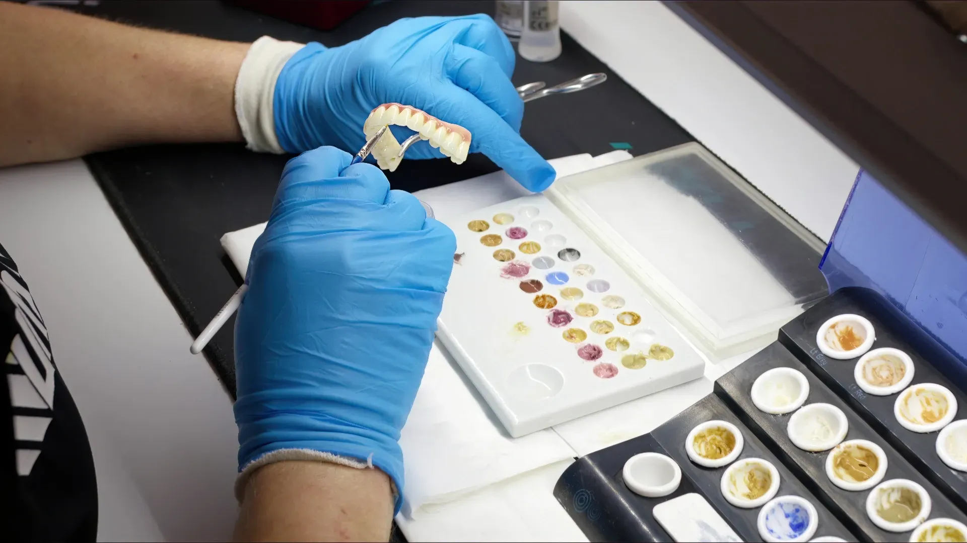 Person Working on a Dental Appliance — AB Esthetic Dental Laboratory in Sunshine Coast, QLD