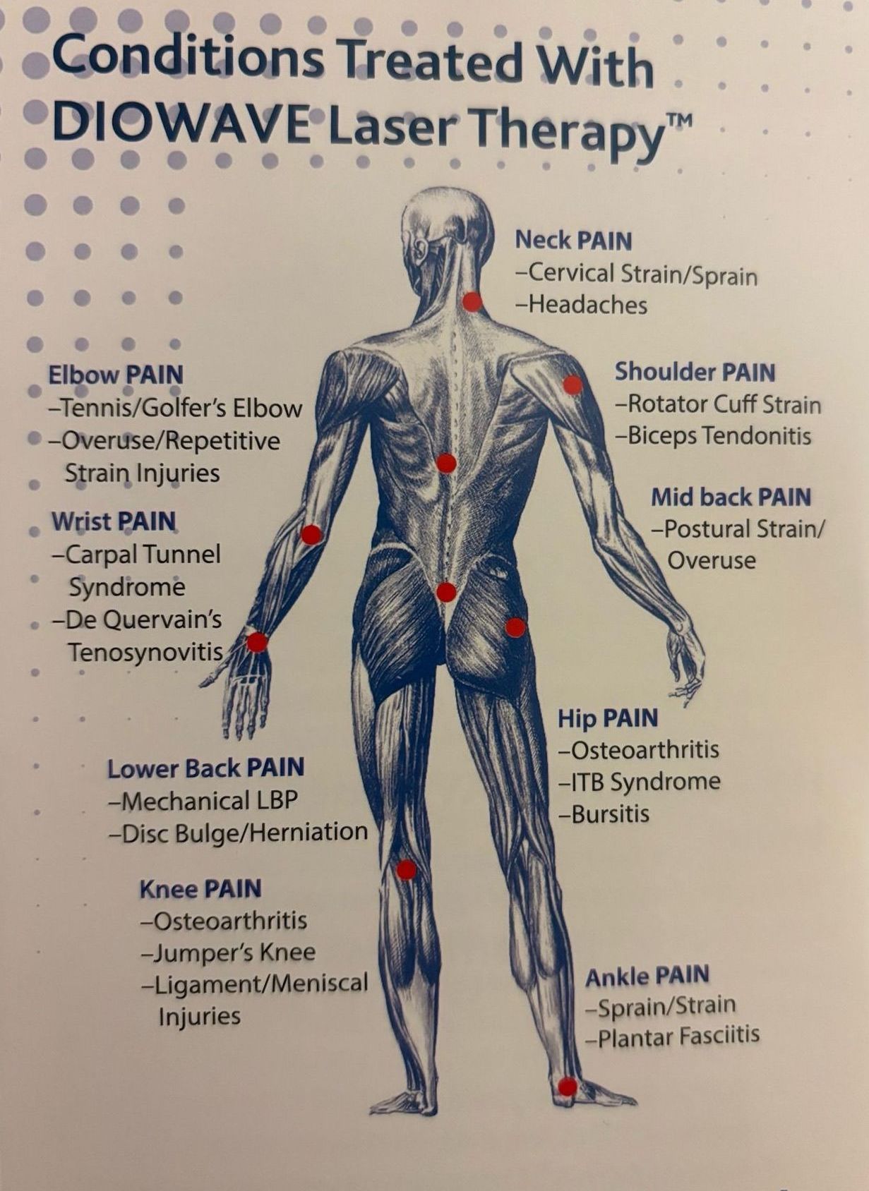 A diagram of a man 's body showing the conditions treated with diowave laser therapy