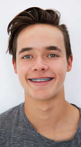 A young man with braces on his teeth is smiling for the camera.