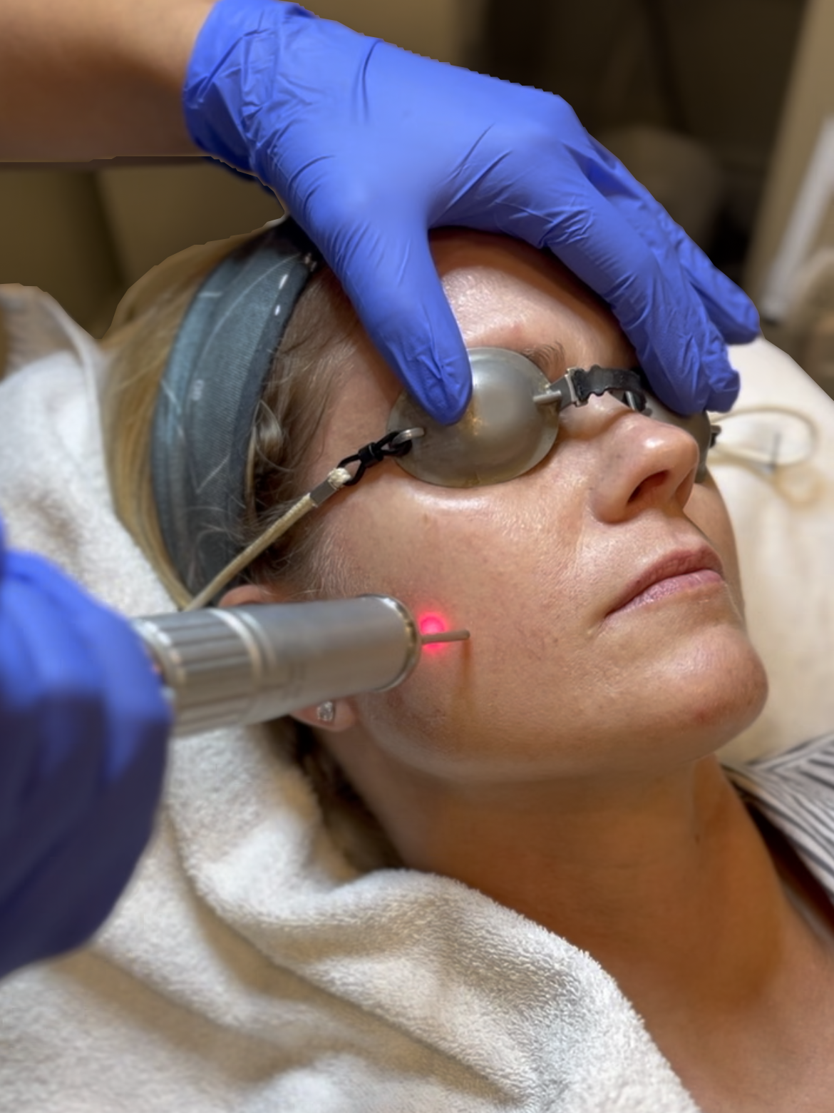 A woman is getting a laser treatment on her face.