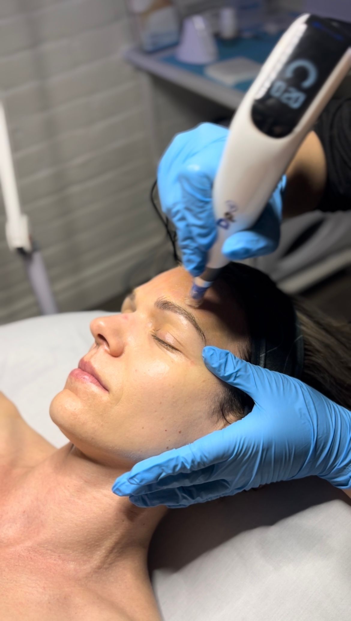 A woman is laying on a bed getting a treatment on her face.