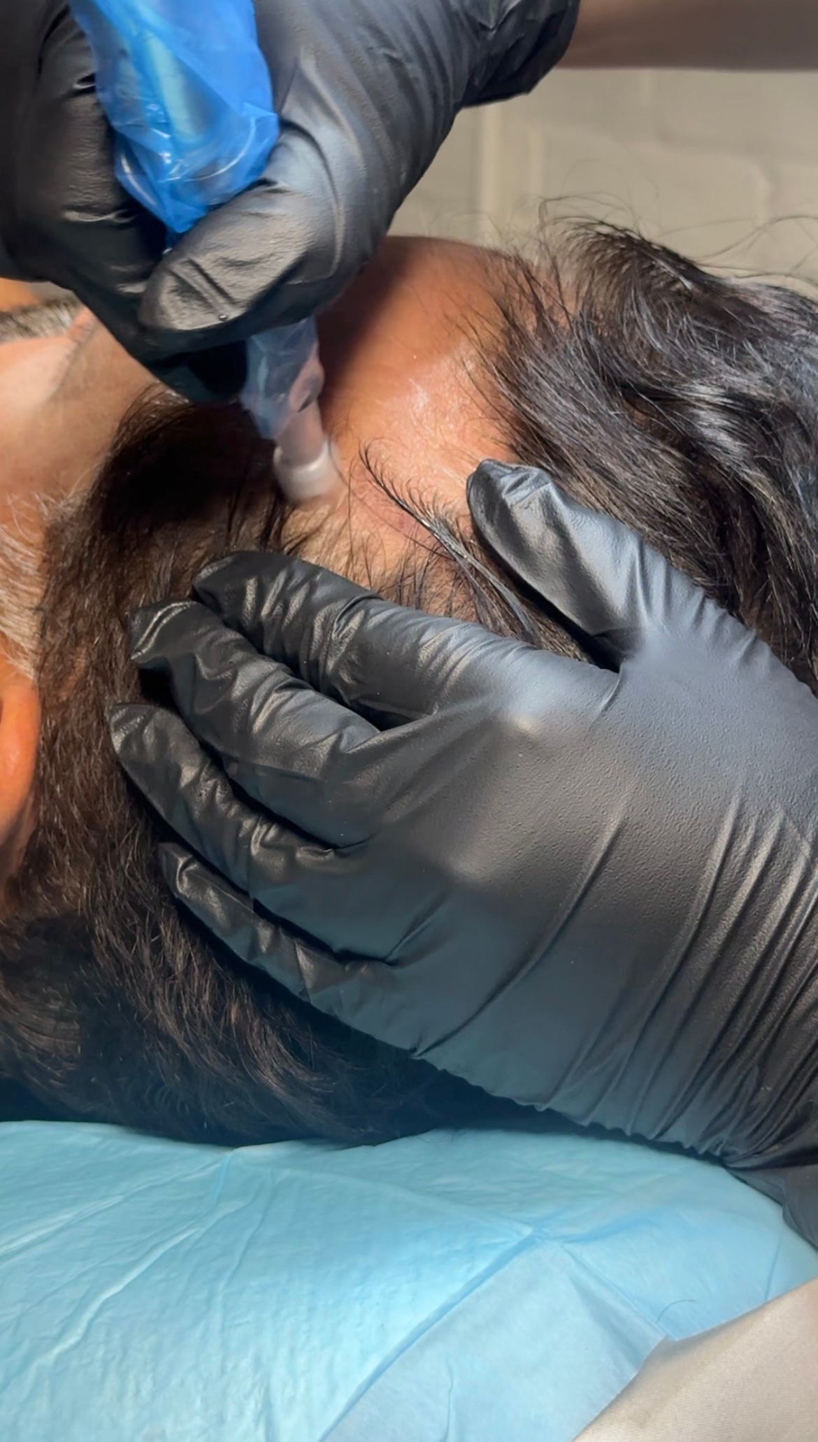 A man is getting a tattoo on his head while wearing black gloves.