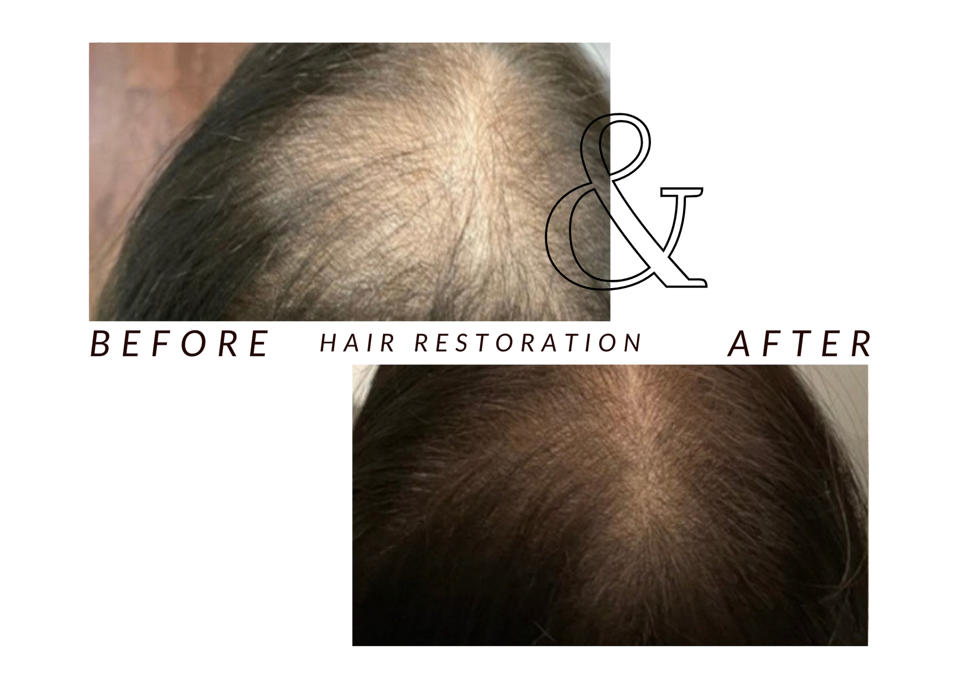 A before and after photo of a woman 's hair restoration