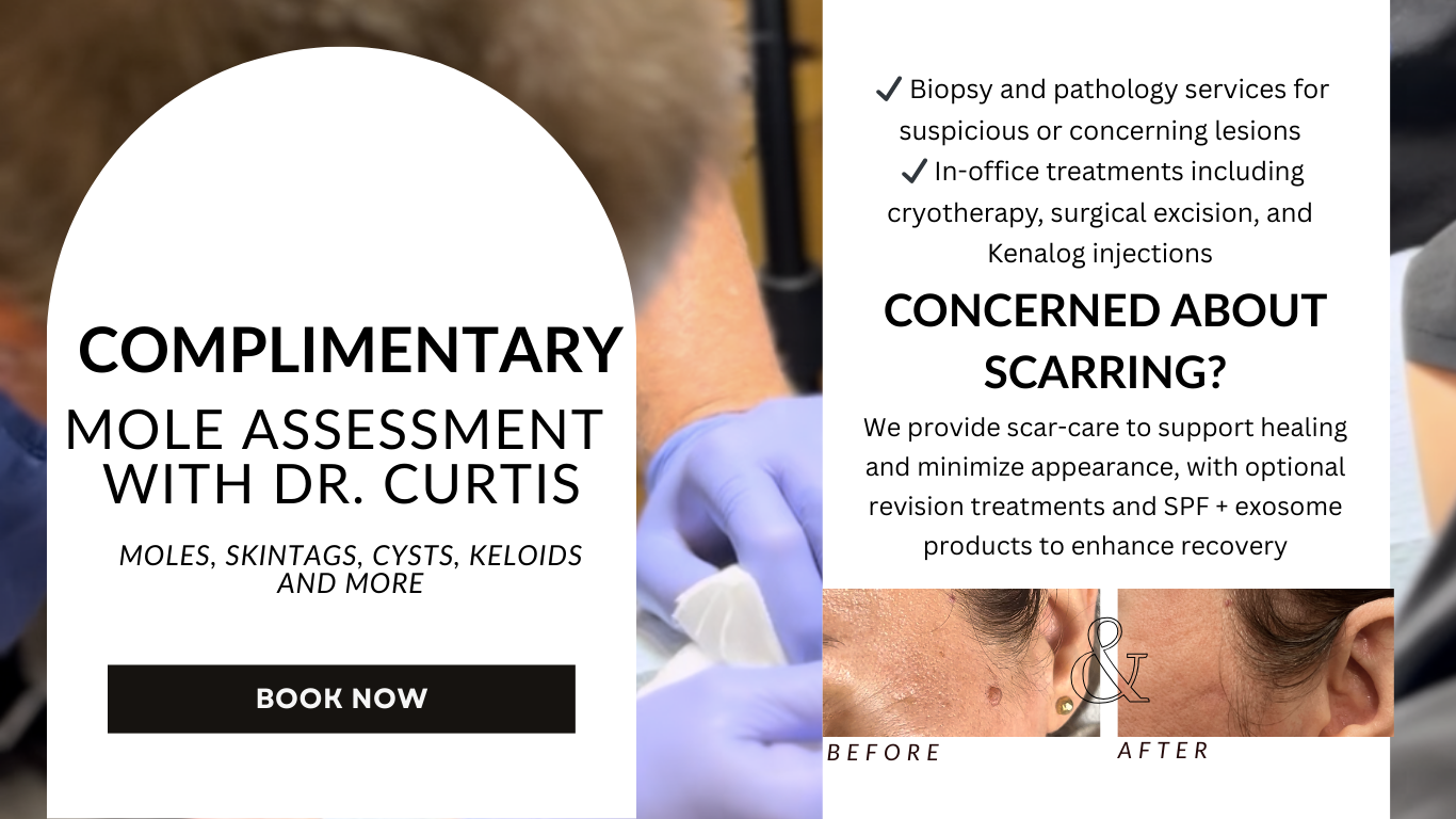 Ad for mole assessment: text over a medical setting. Includes 