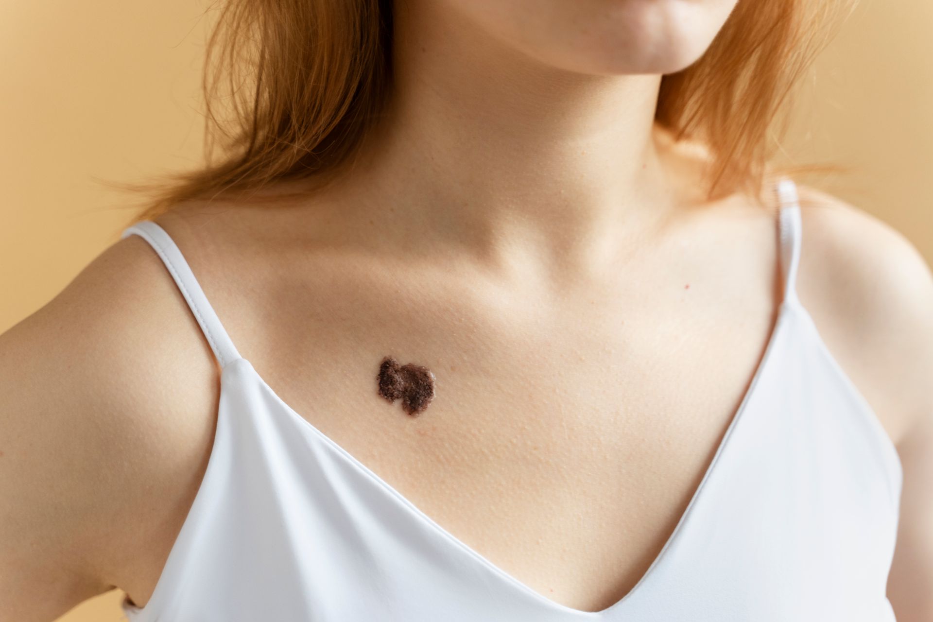 A woman in a white tank top has a black spot on her chest.