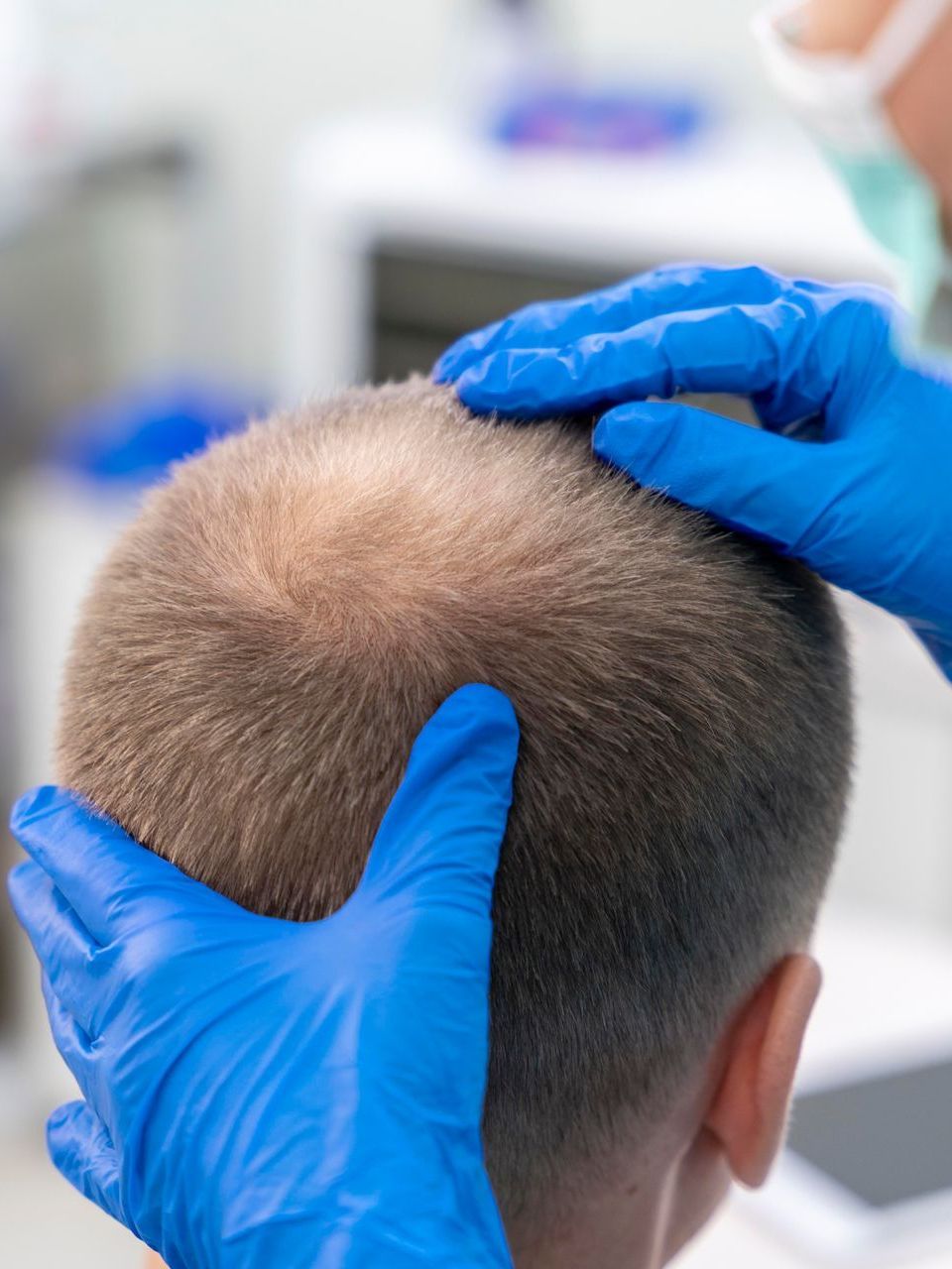 A person wearing blue gloves is examining a man 's hair.