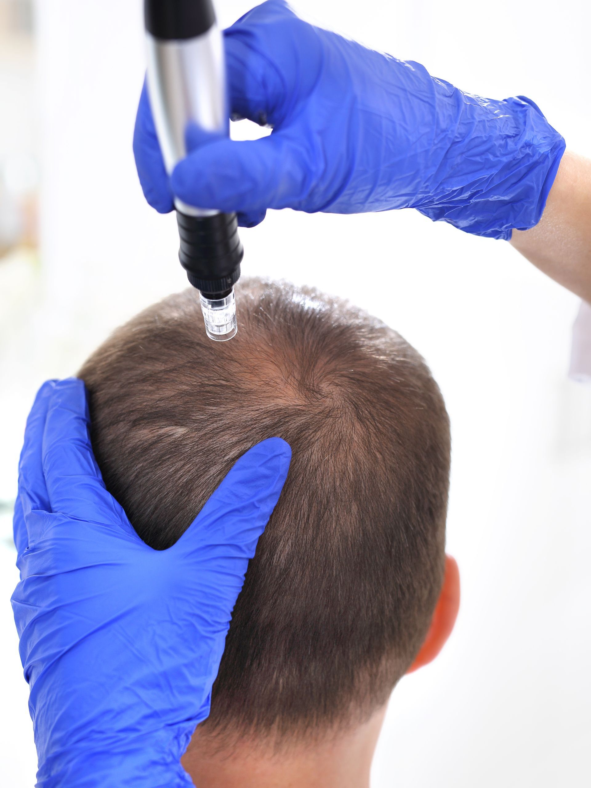 A man is getting a hair treatment from a doctor.