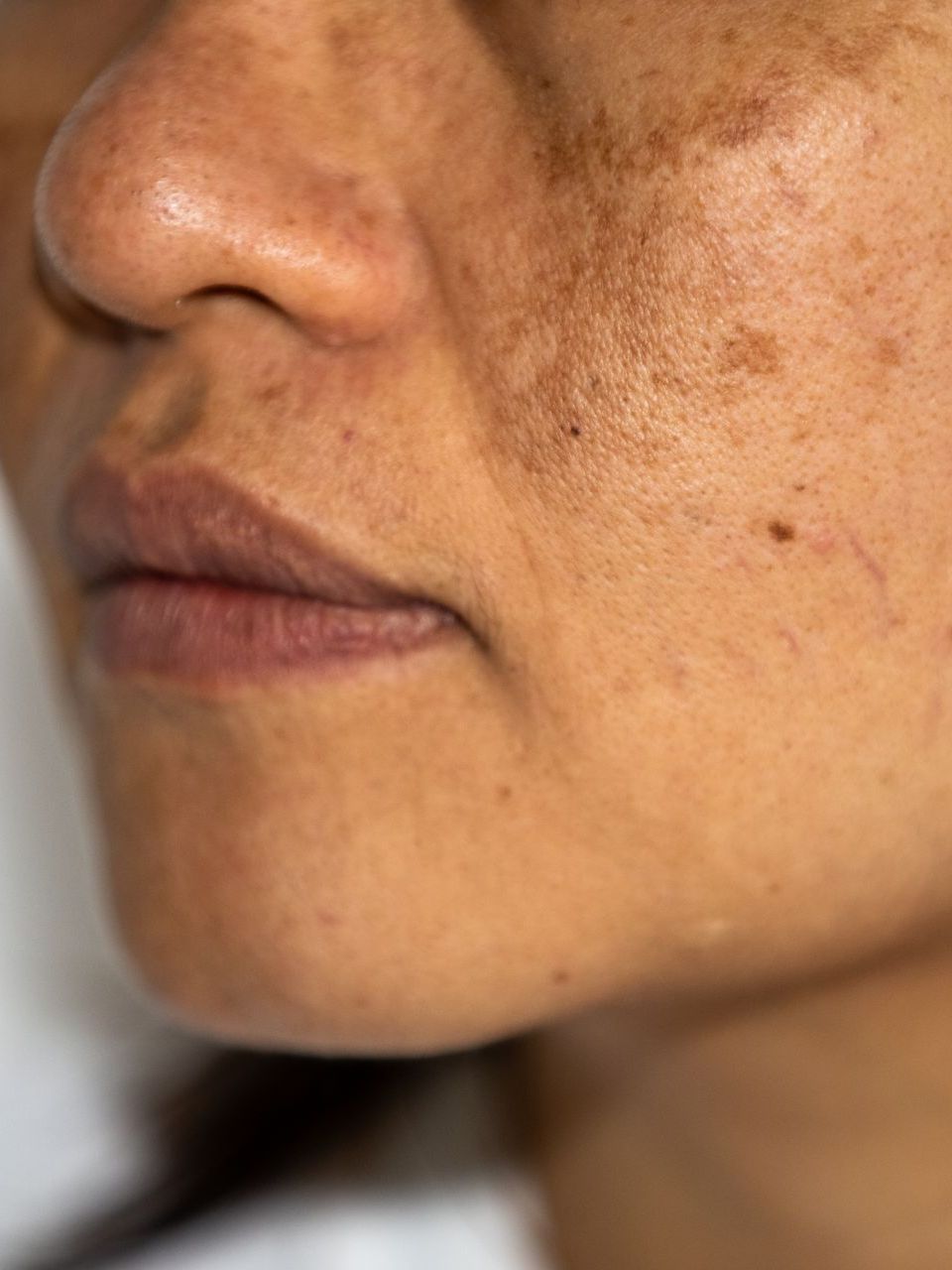 A close up of a woman 's face with freckles on it.