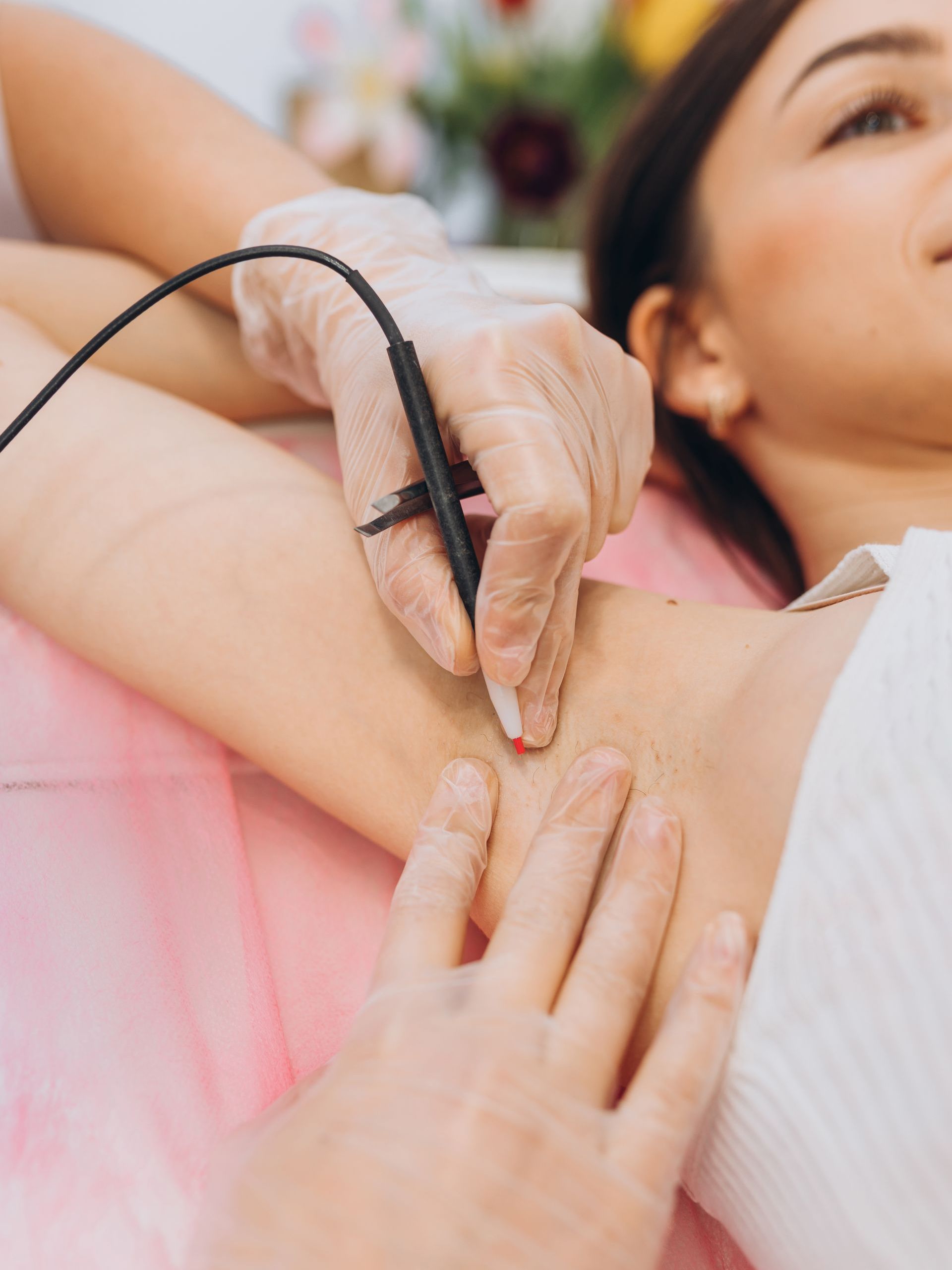 A woman is getting an electrolysis treatment on her armpit.