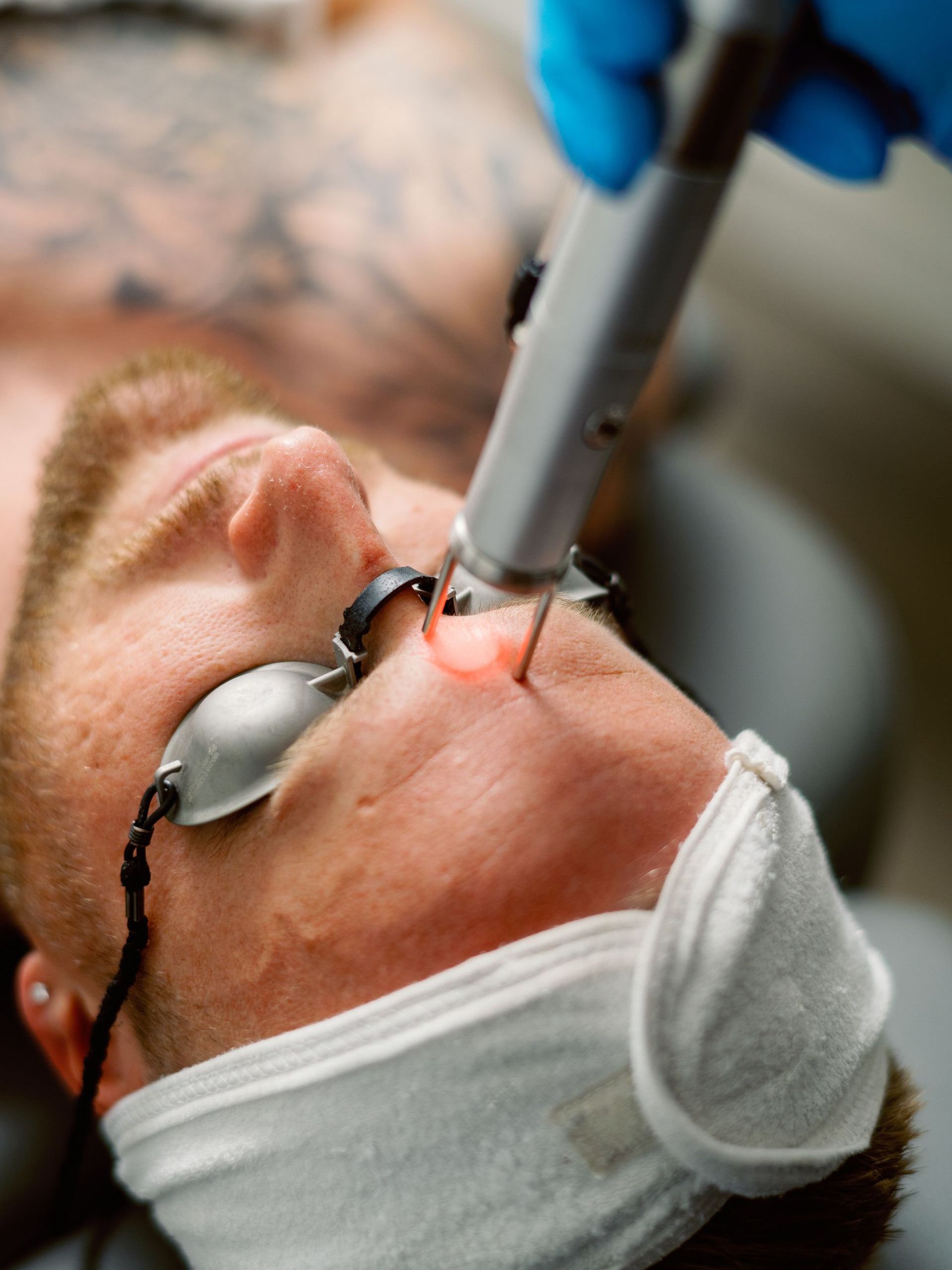 A man is getting a laser treatment on his face.