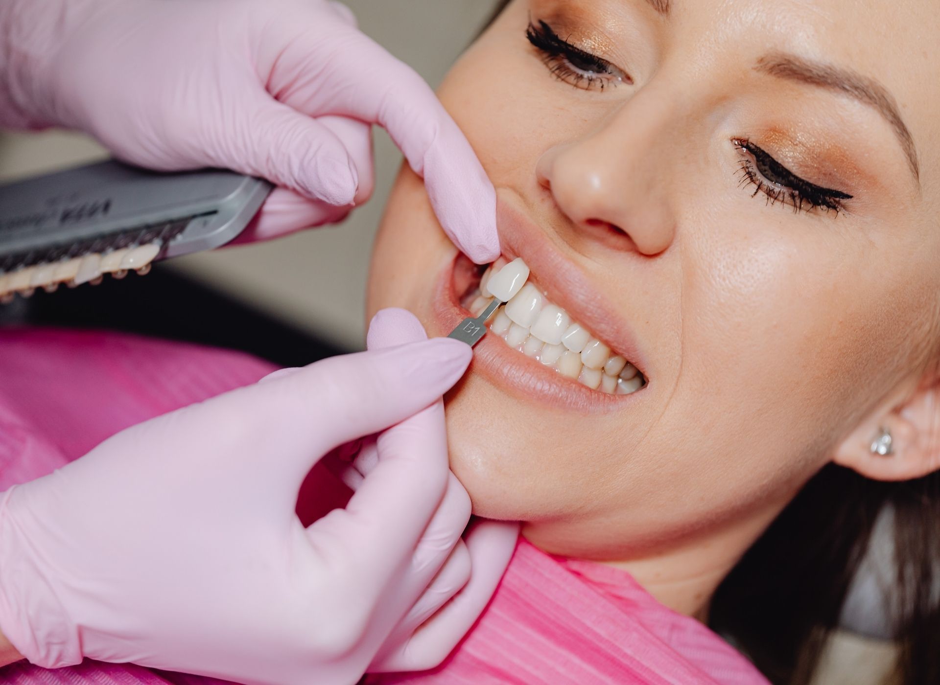 Dentist comparing tooth shade with a patient's natural teeth; dentist's hands in pink gloves, close-up.