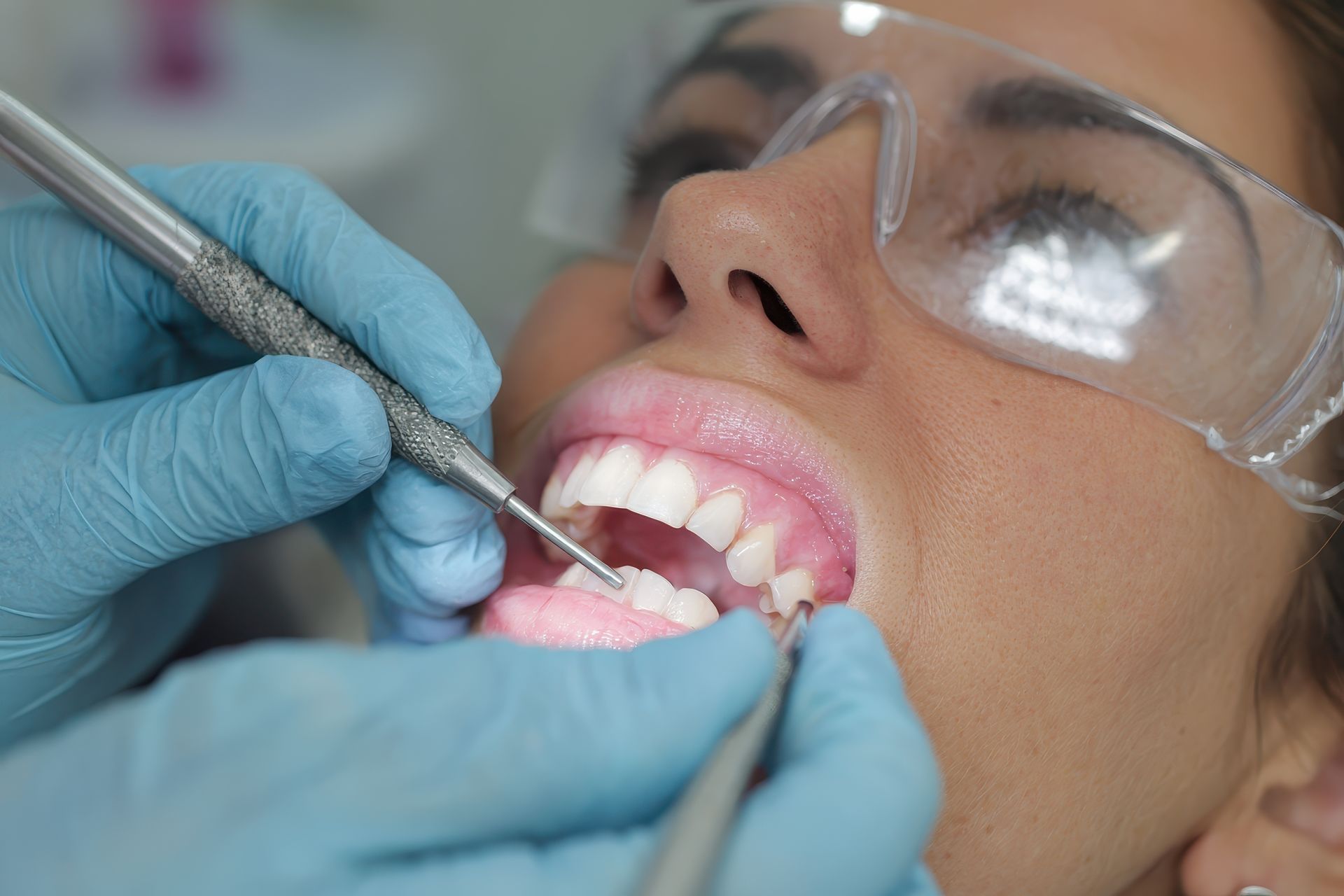 Dentist examining a patient's teeth with tools in a dental office; patient wears safety glasses and mouth is open.
