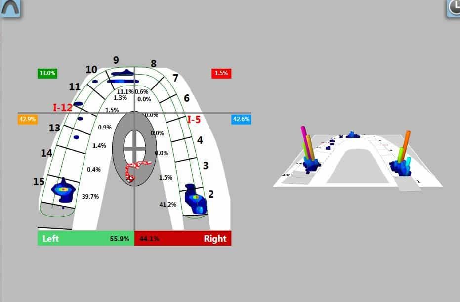 James A. Oshetski, DDS, Implant and Restorative Dentistry - Dental scan visualizes tooth alignment, featuring a curved arch, percentages, and colored markers indicating left/right sides.