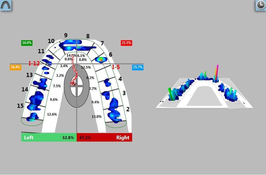 James A. Oshetski, DDS, Implant and Restorative Dentistry - Dental implant components: artificial tooth and titanium screw on blue background.