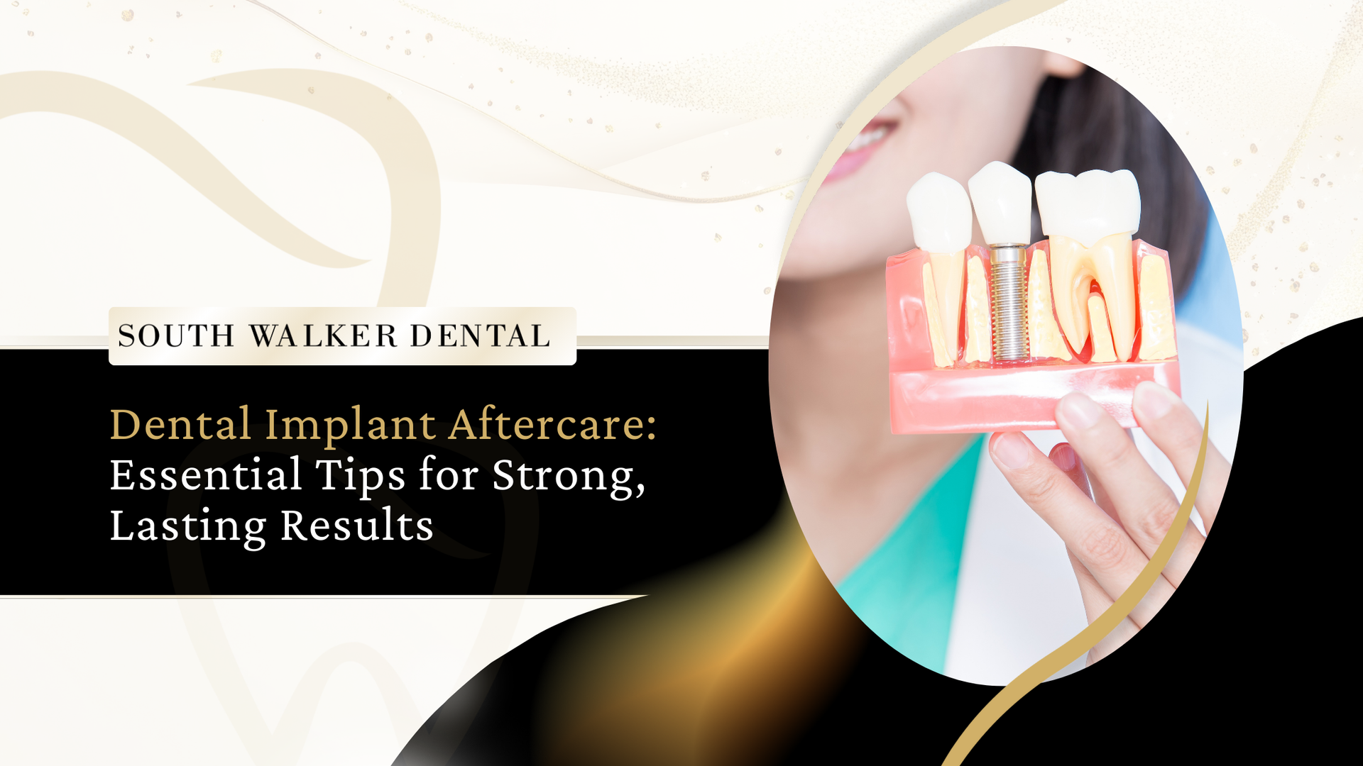 Woman holding model of dental implant, white teeth on display. Text: Dental Implant Aftercare.