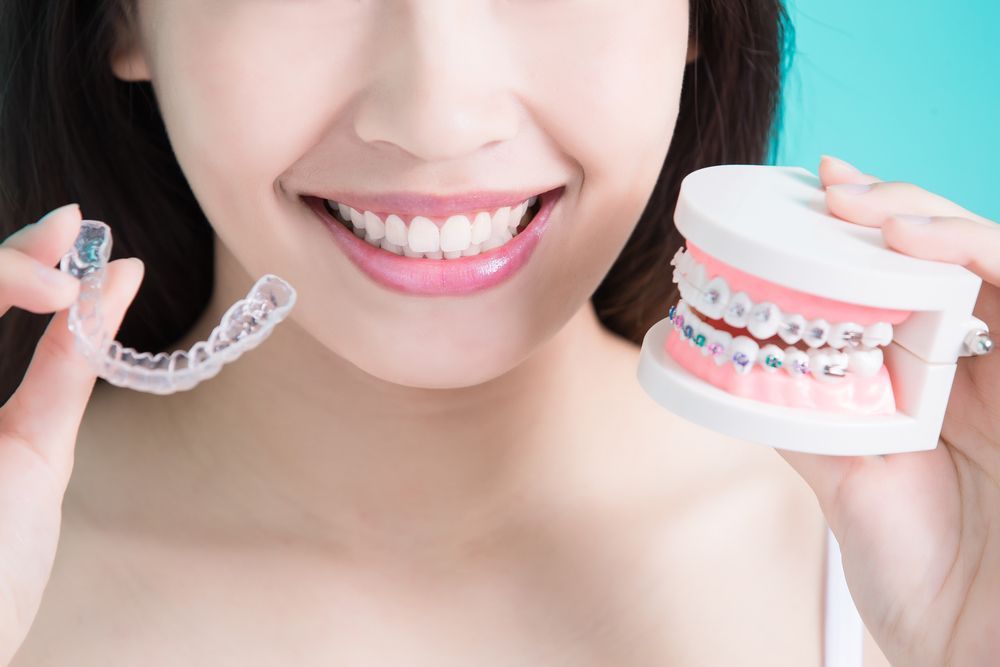 Woman smiling, holding clear aligner and model of teeth with metal braces.