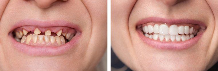 restorative dentistry