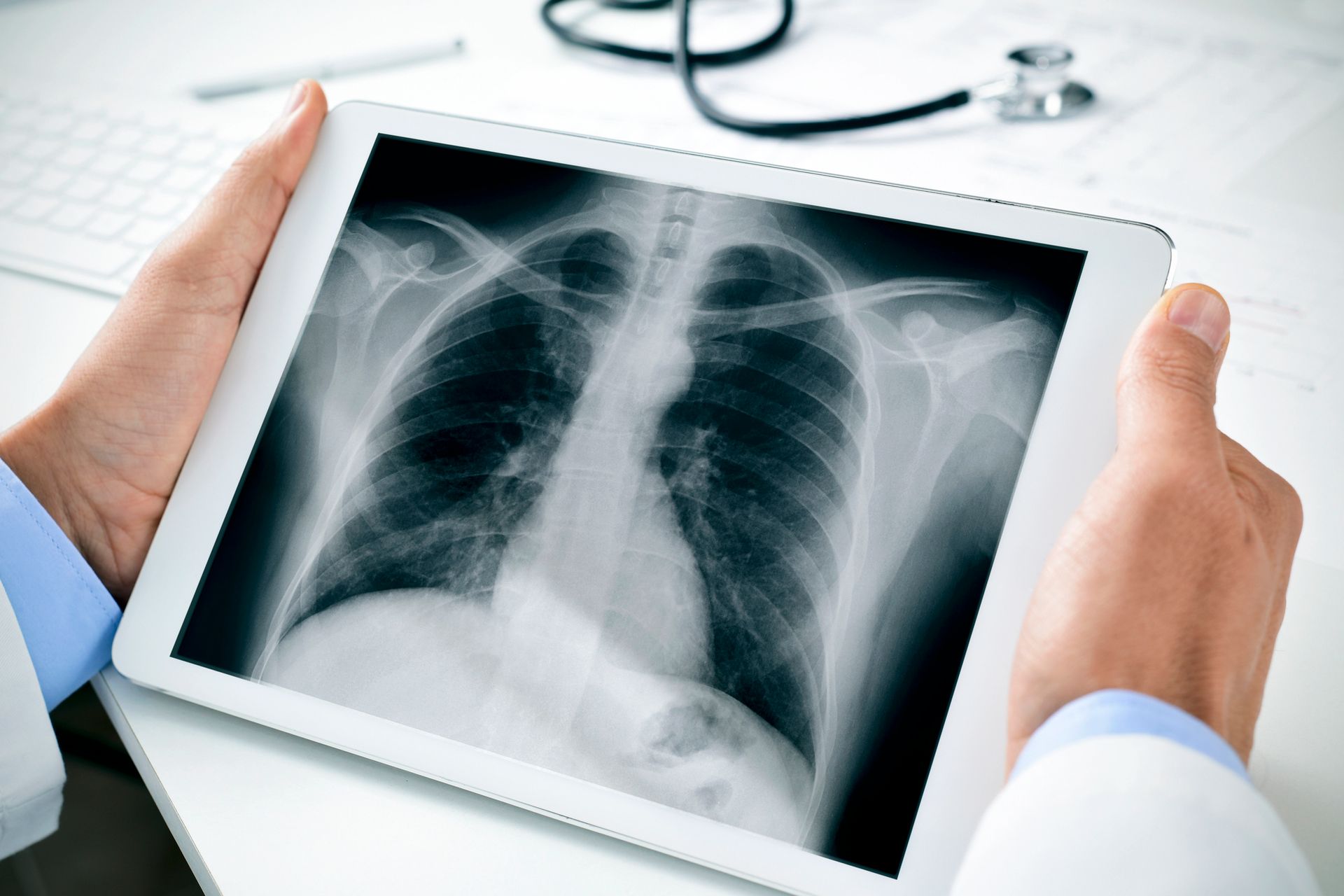 Un medico in uno studio medico tiene in mano un tablet che mostra una radiografia del torace.