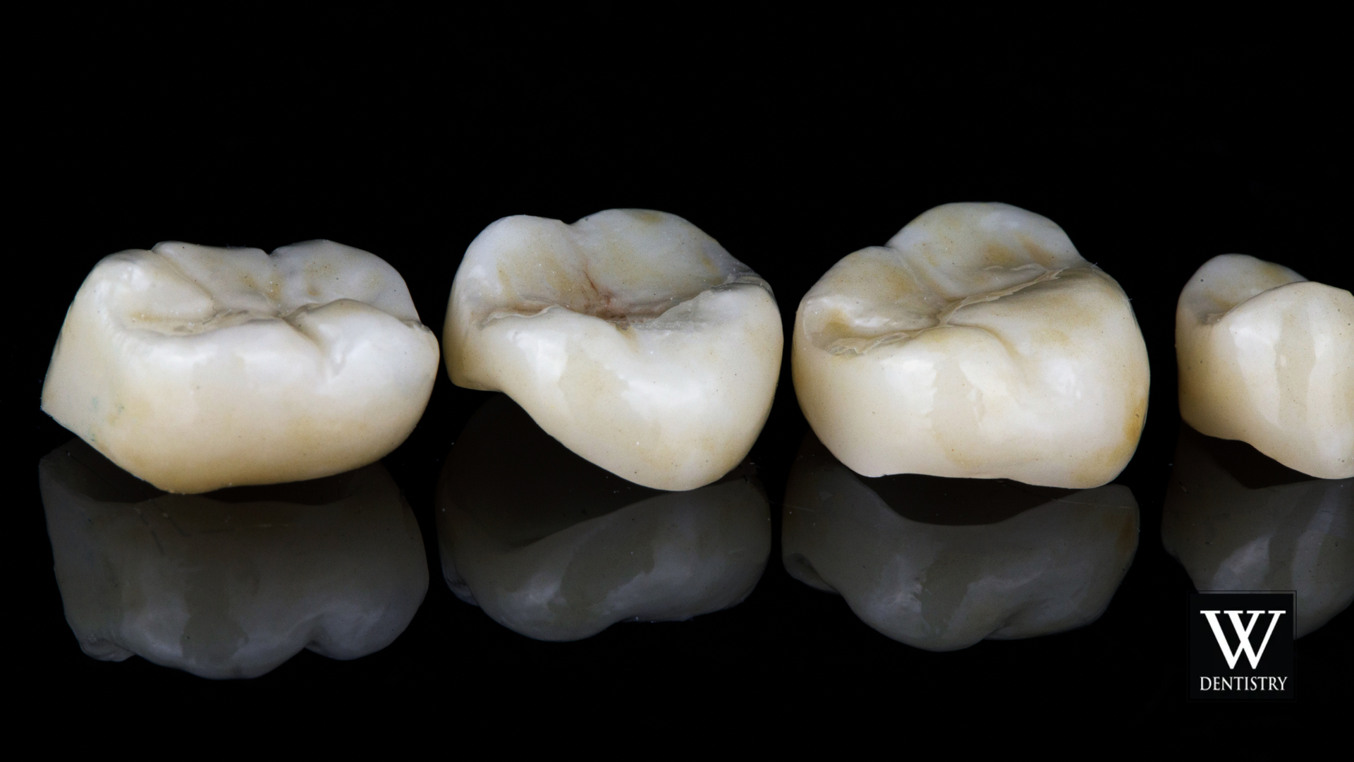 Four dental crowns, light beige with darker ridges, arranged on a reflective black surface.