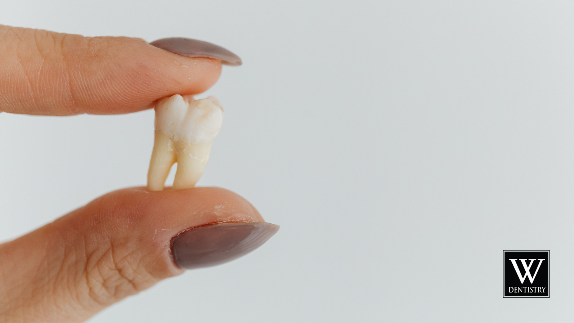 Hand holding a removed molar tooth against a white background.