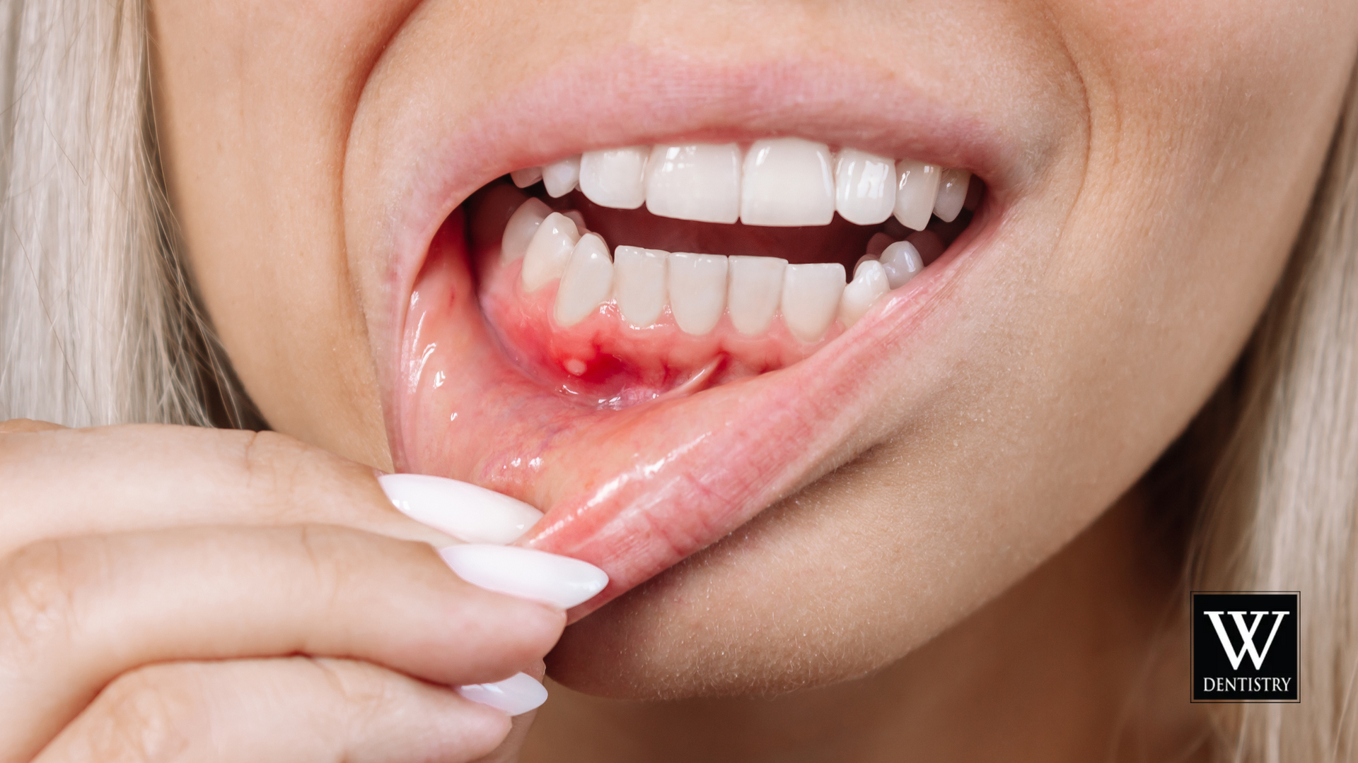 A close up of a woman 's mouth with a toothache.