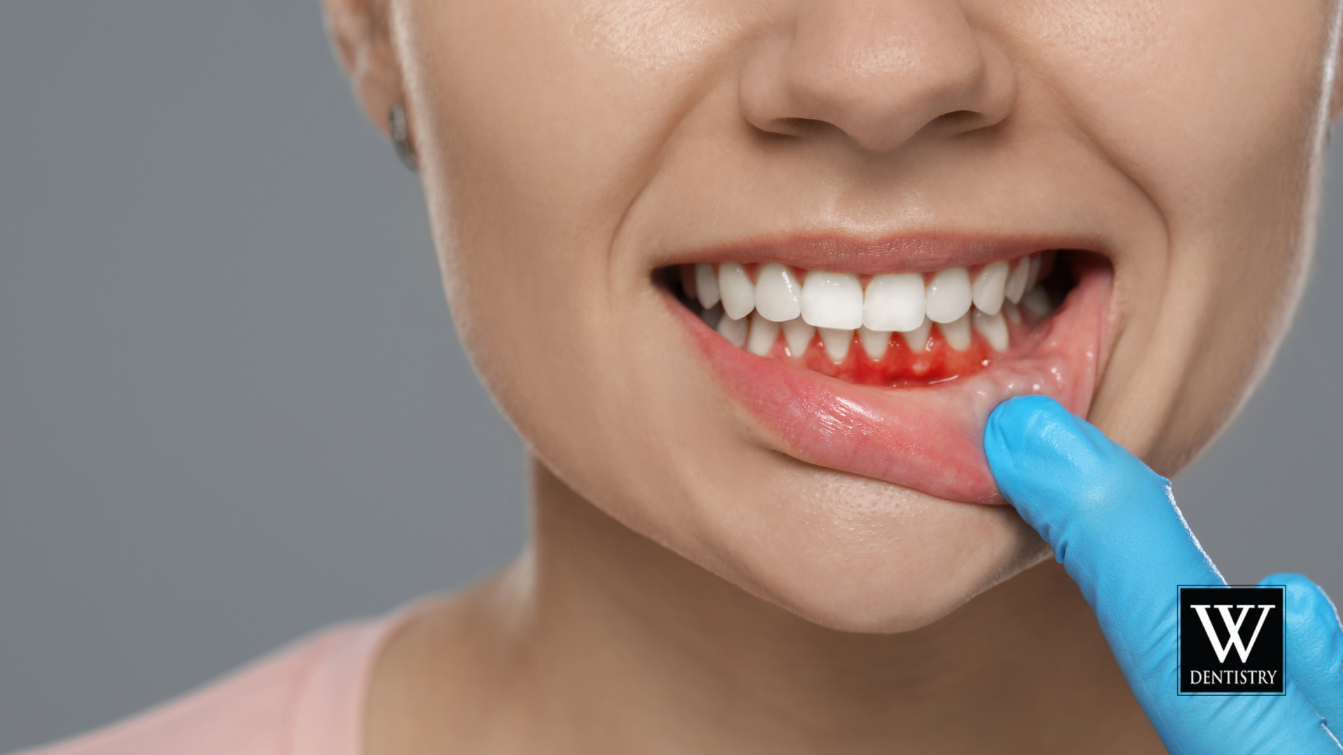 A woman is getting her teeth examined by a dentist.