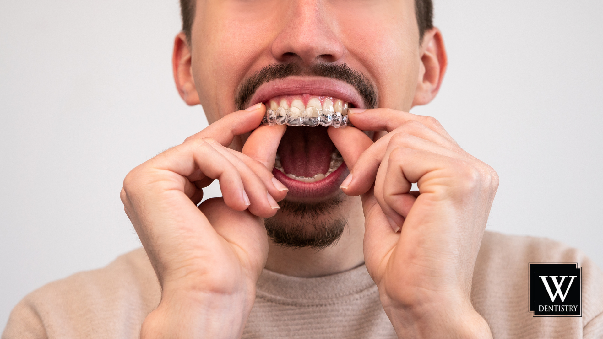 A man with braces on his teeth is holding his mouth open.