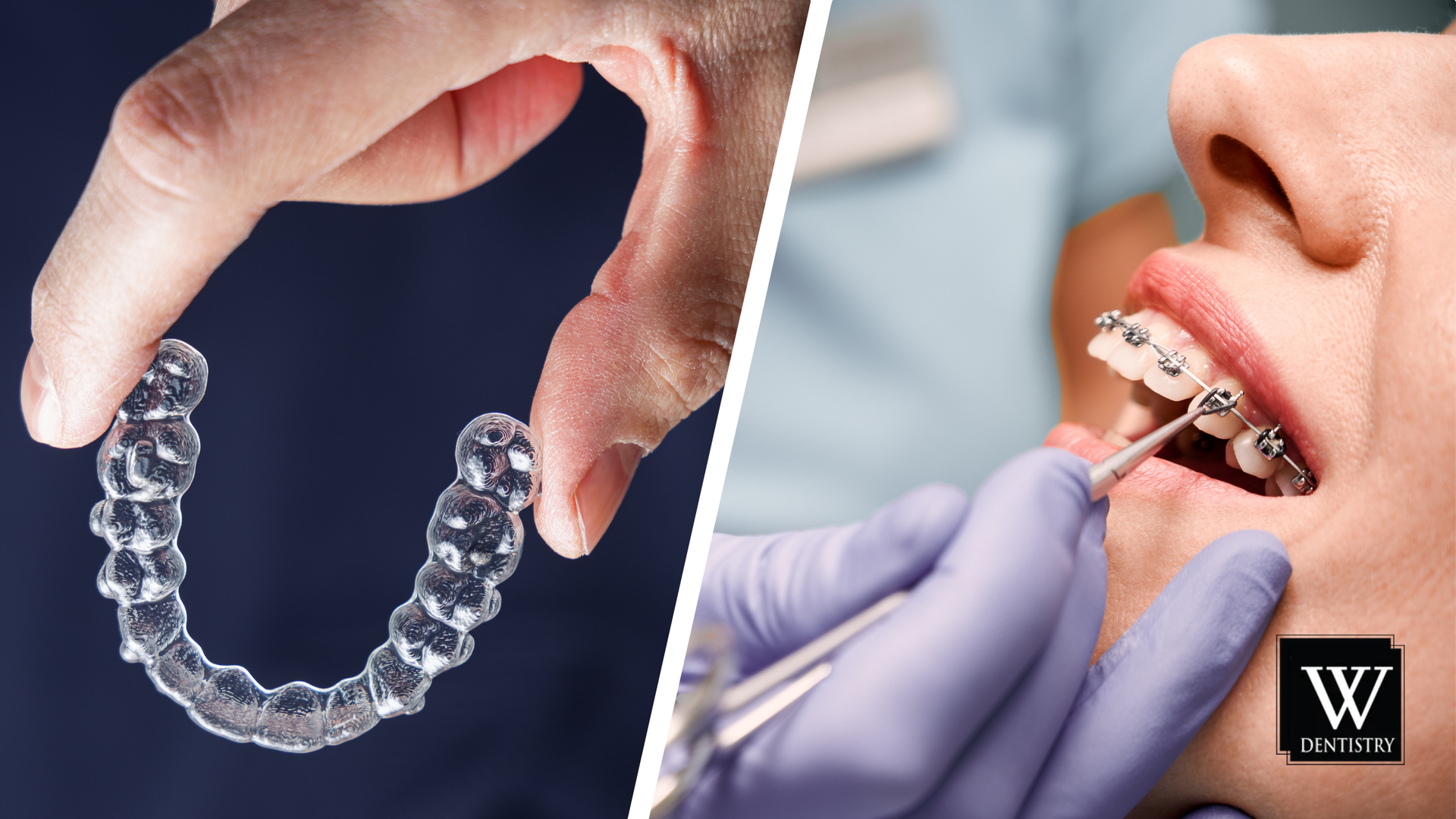 A person is holding a clear retainer next to a person with braces on their teeth