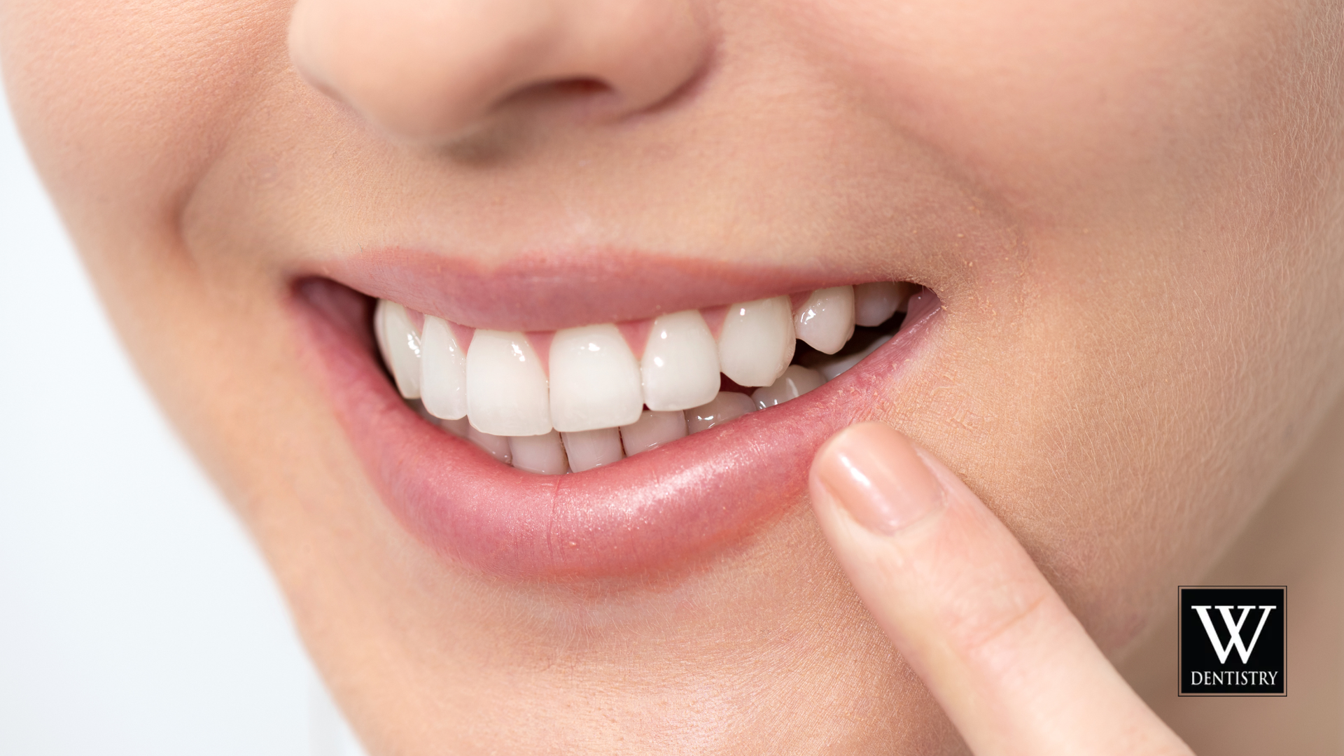 Close-up of a person's smiling mouth, showing bright white teeth. A finger points towards the teeth.
