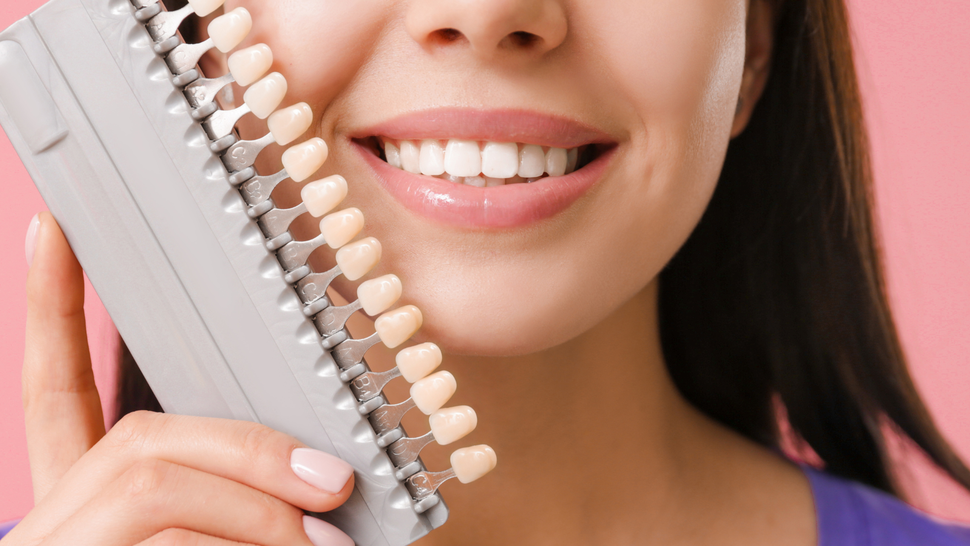 5 Signs You Could Benefit from Cosmetic Veneers