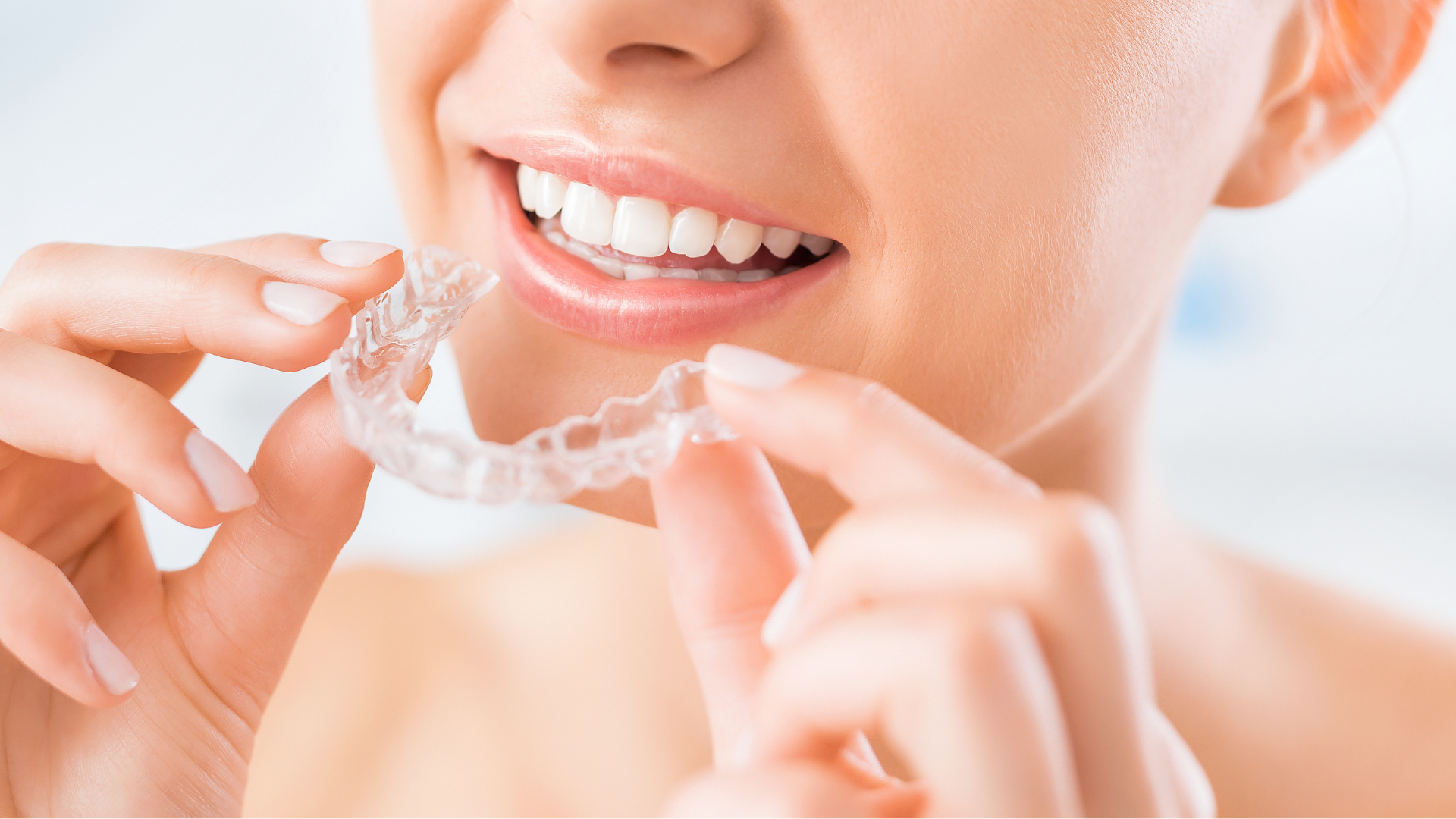 10 Common Questions About Invisalign Answered by Experts