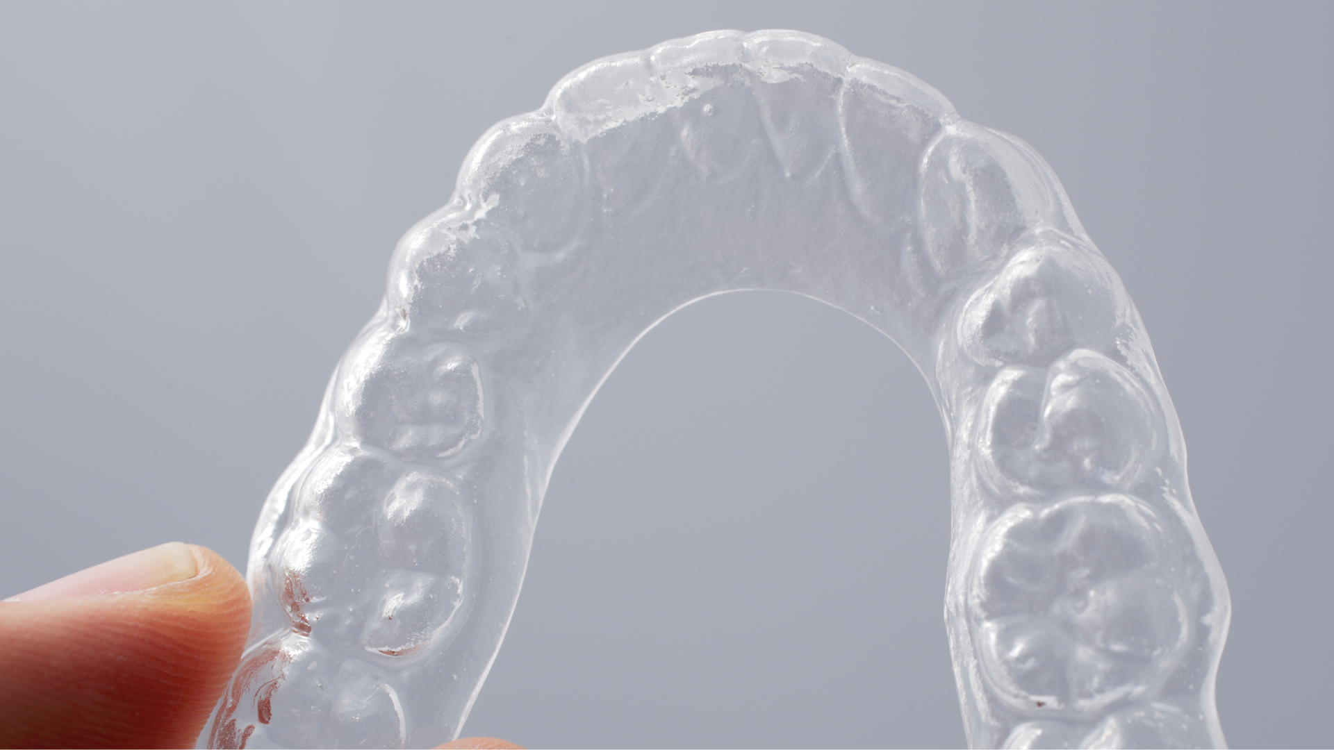 How Much Do SureSmile® Clear Braces Cost? Breaking Down Your Treatment Investment
