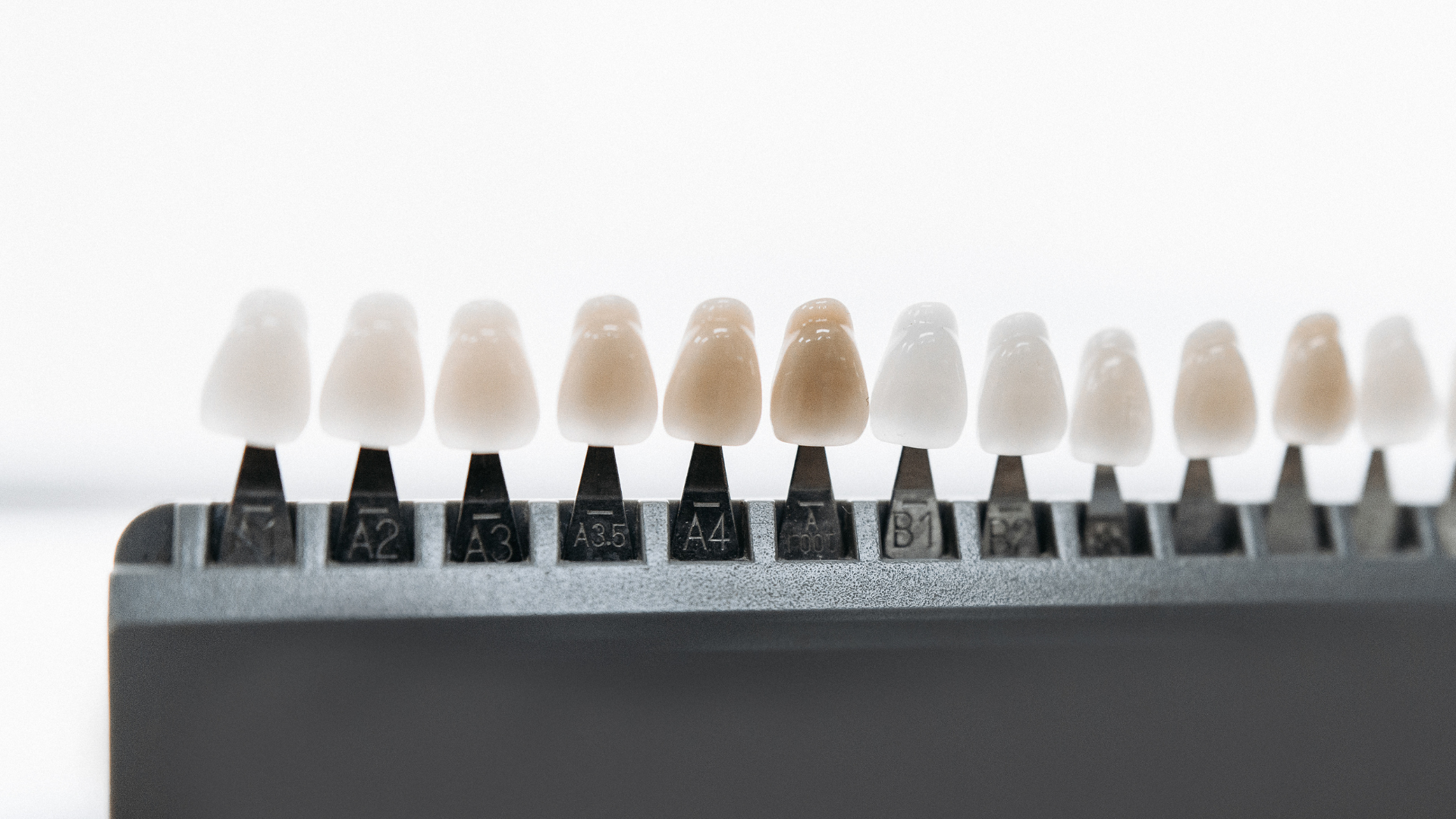 The Cost of Veneers: Breaking Down What You’re Really Paying For