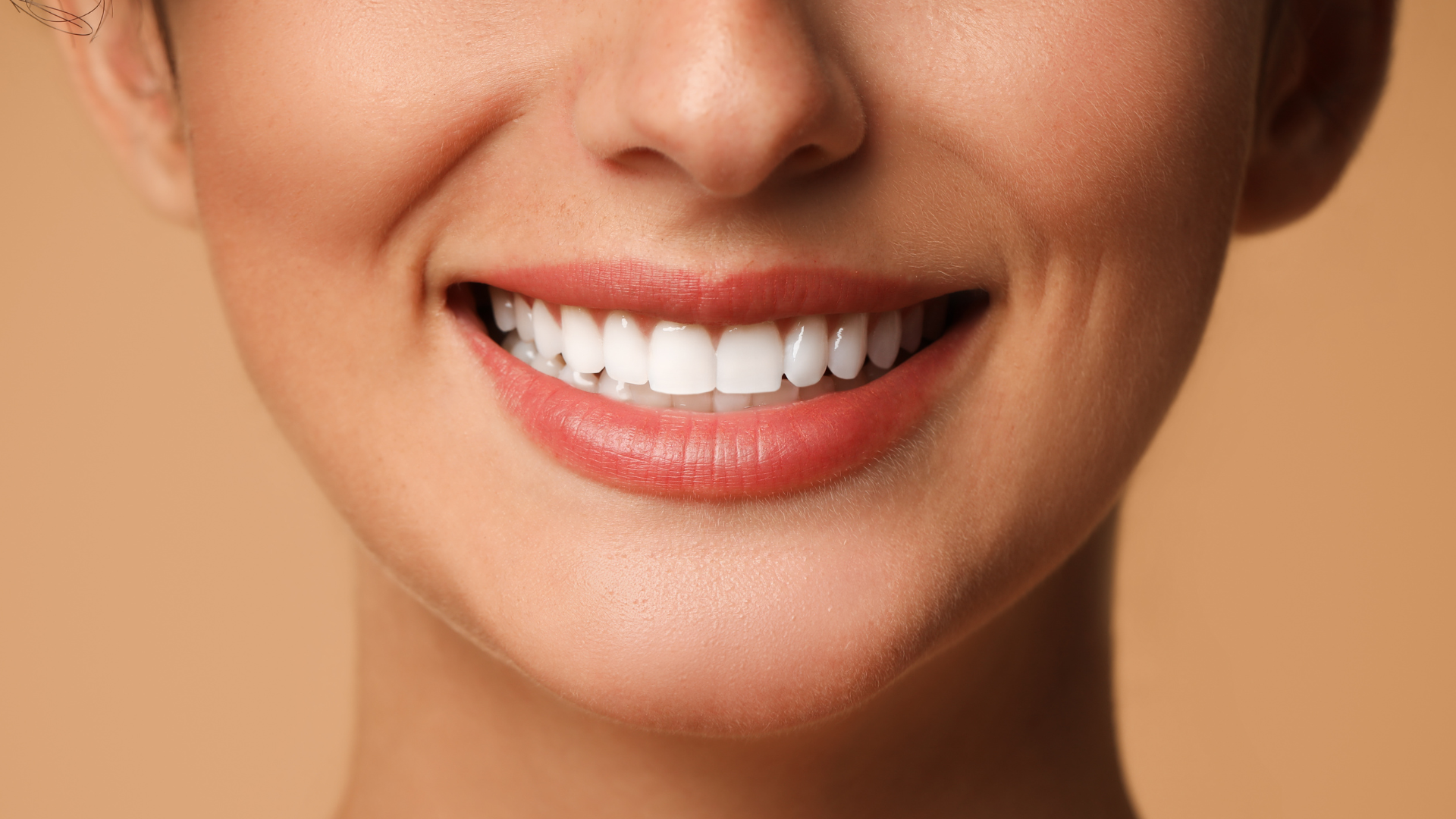 Top Celebrities Who Have Veneers (and What We Can Learn from Their Smiles)