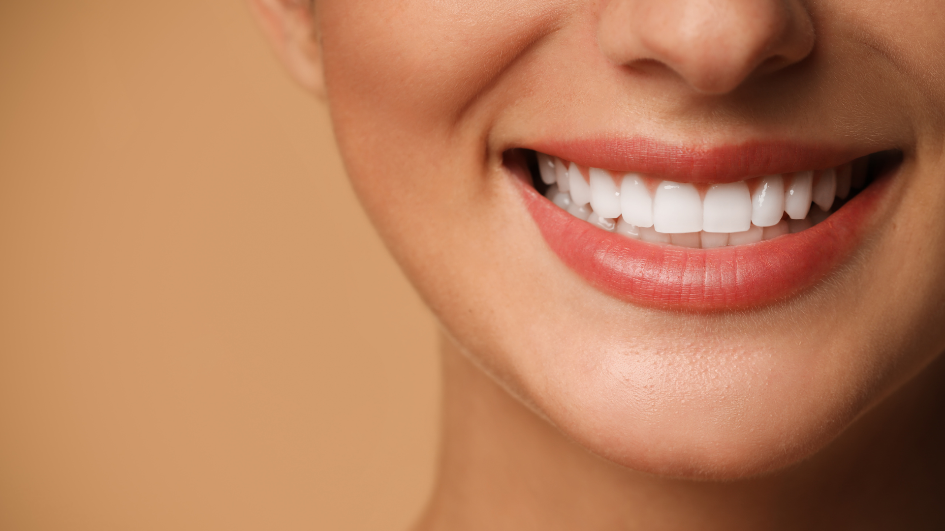 Transform Your Smile: Everything You Need to Know About Veneers