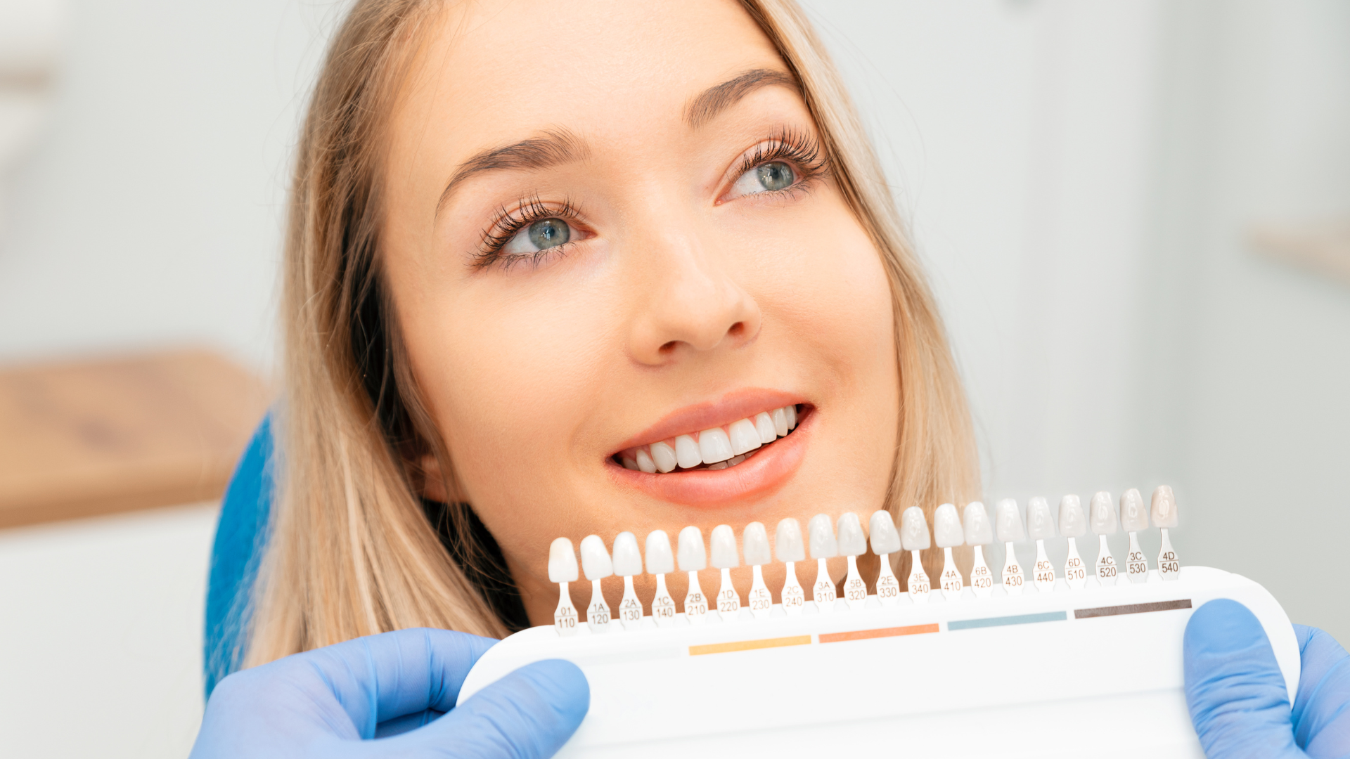 How Long Do Veneers Last? Durability, Cost, and Care Explained