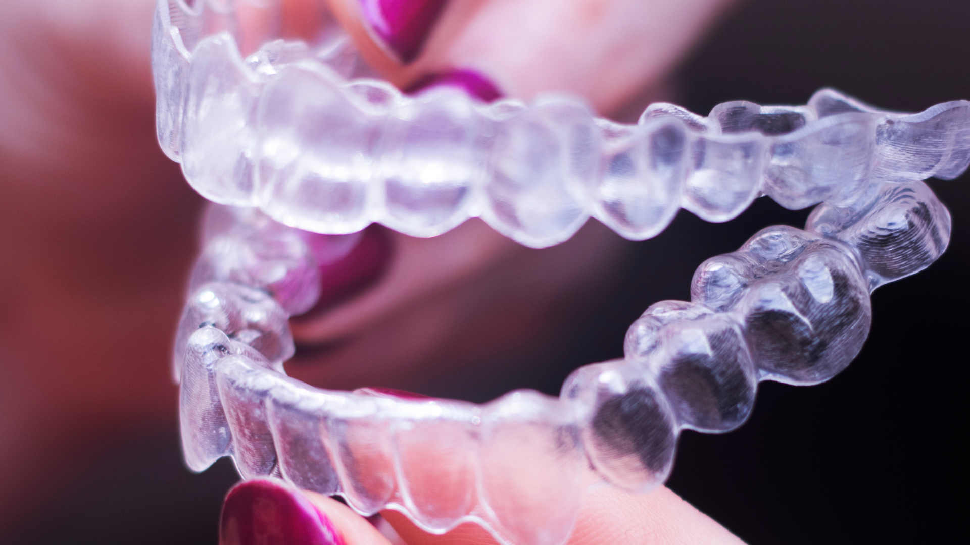 Are SureSmile® Clear Braces Worth It? What to Expect
