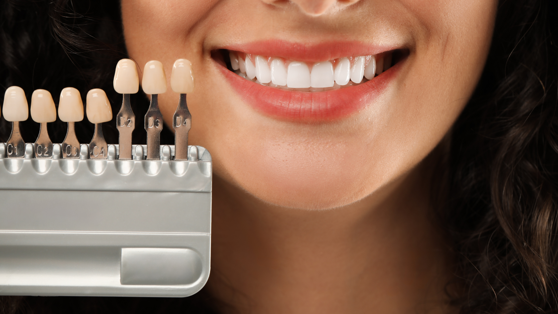 Veneers 101: How They Enhance Both Appearance and Confidence