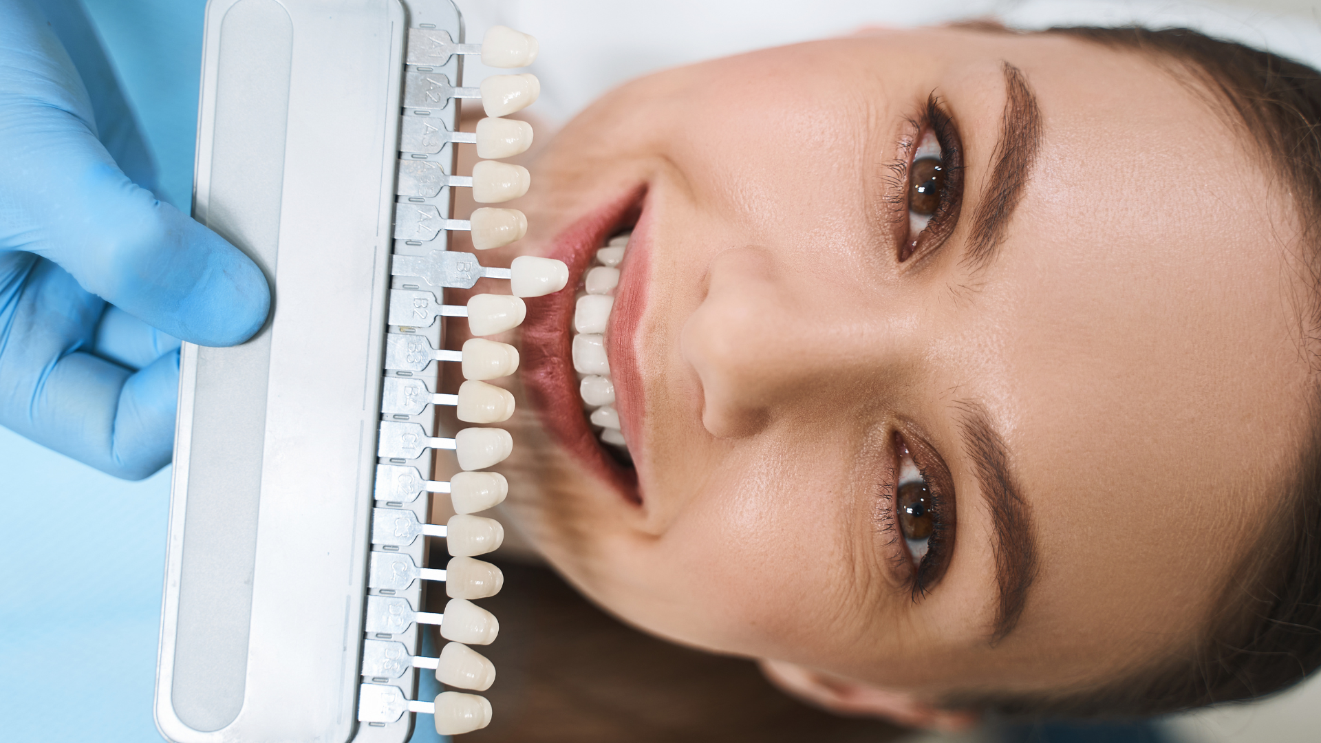 What Your Smile Says About You: How Veneers Can Reshape First Impressions