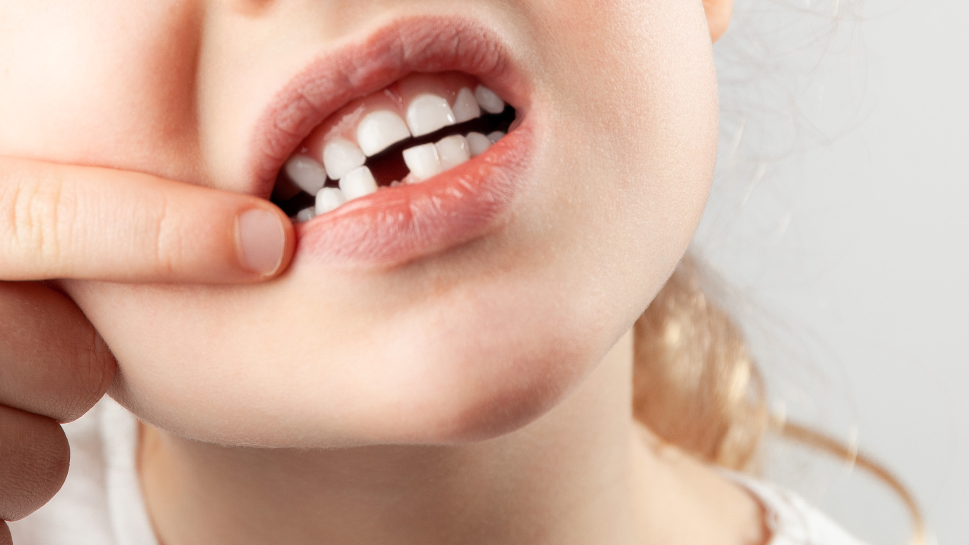 How Fast Should You Respond to a Knocked-Out Tooth?