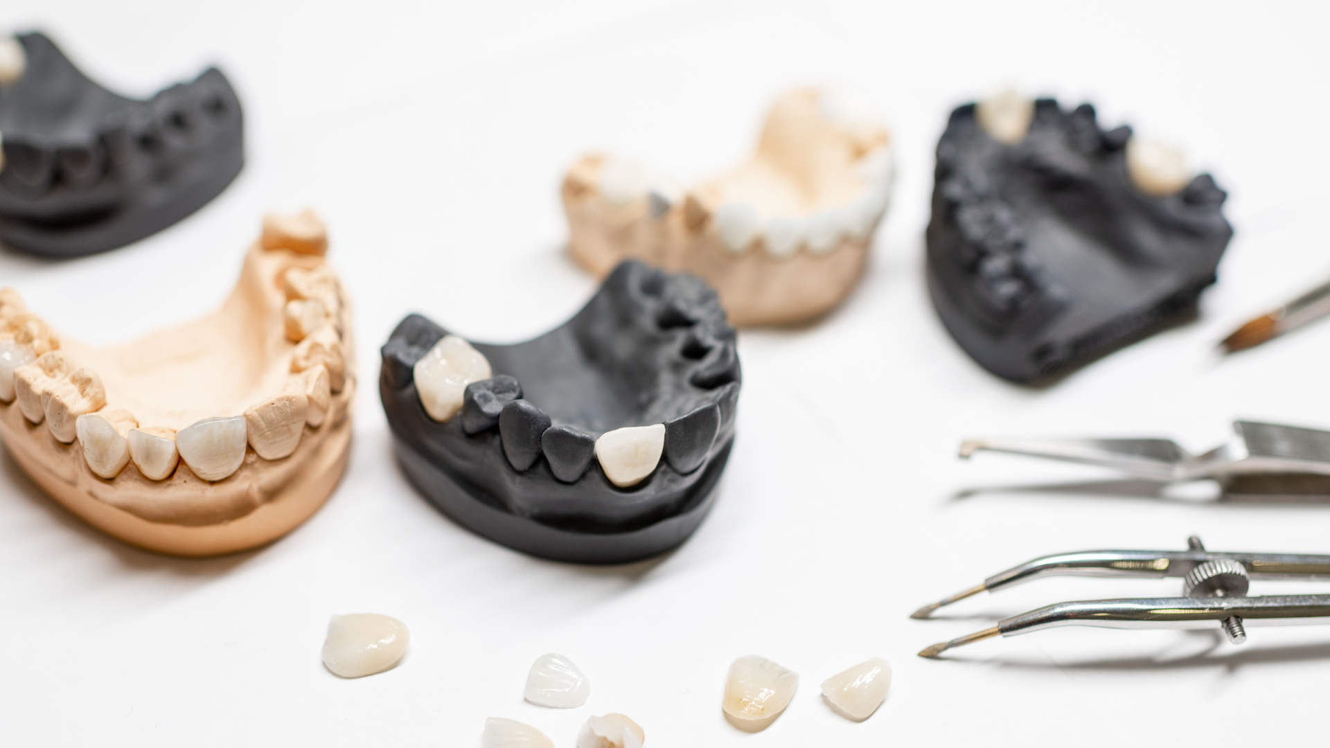 Do Veneers Damage Your Natural Teeth? What Patients Should Know