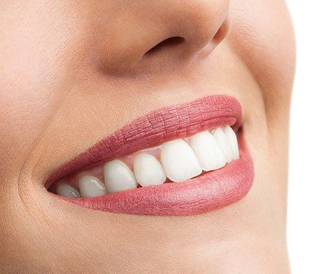 Teeth Whitening — Close up of Perfect Teeth in Tenafly, NJ