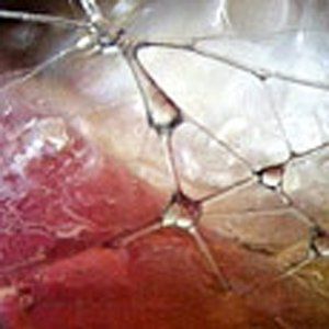 Muscles during Rolfing
