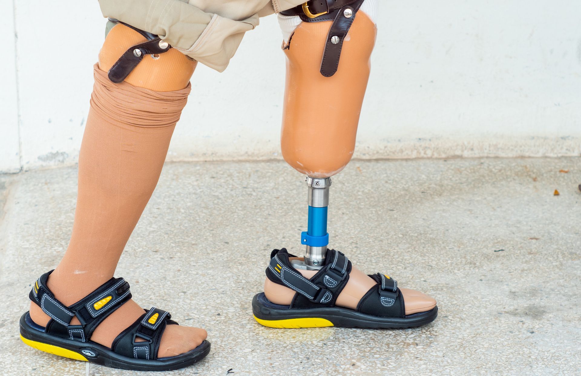 Bilateral amputee with two lower leg prosthetics.