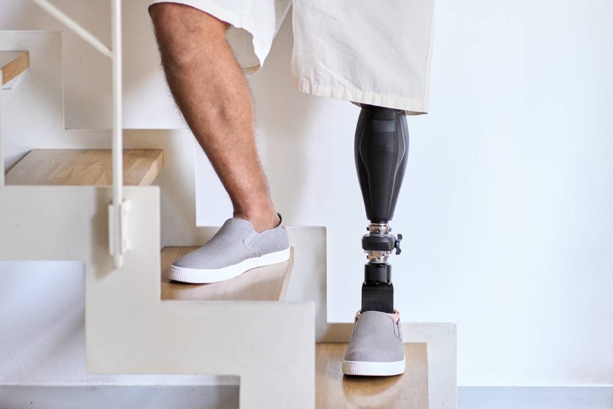 Man with a prosthetic leg standing on a staircase at Durrett’s Orthotics & Prosthetics near Edgewood