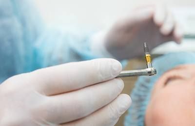 Dental Implant Surgery