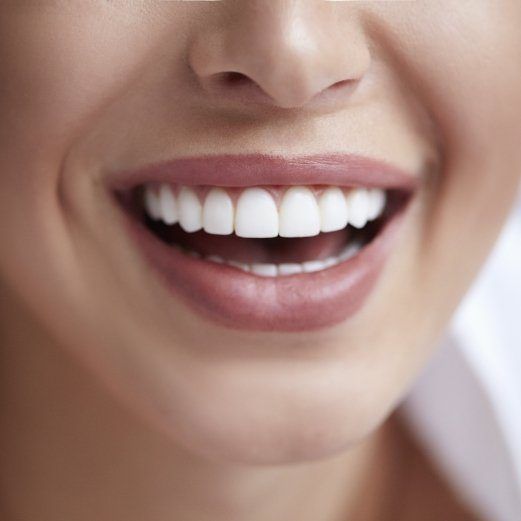 Metal-Free Dental Restorations